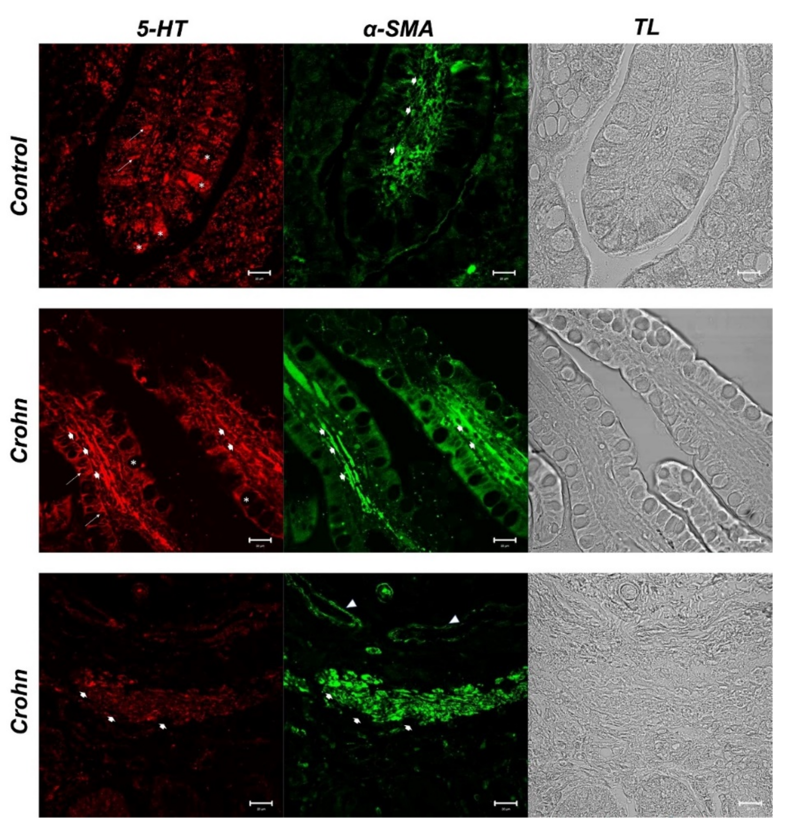 Biomedicines 10 00765 g002 Biomedicines 10 00765 g002