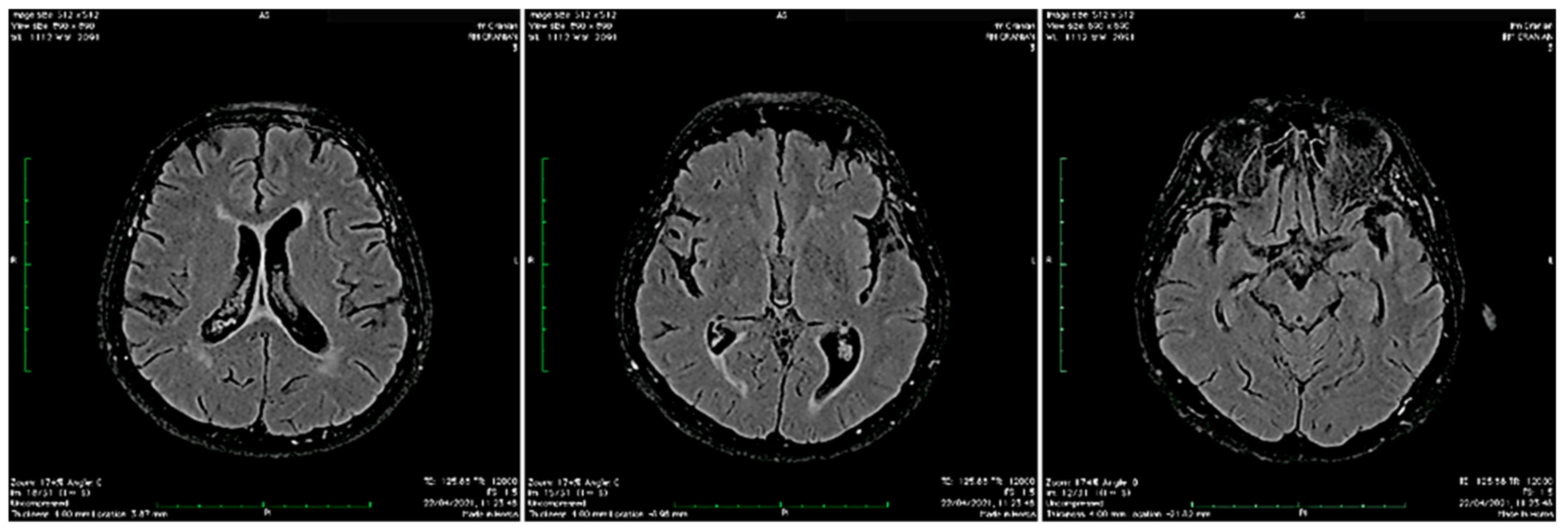 Biomedicines 10 00774 g002