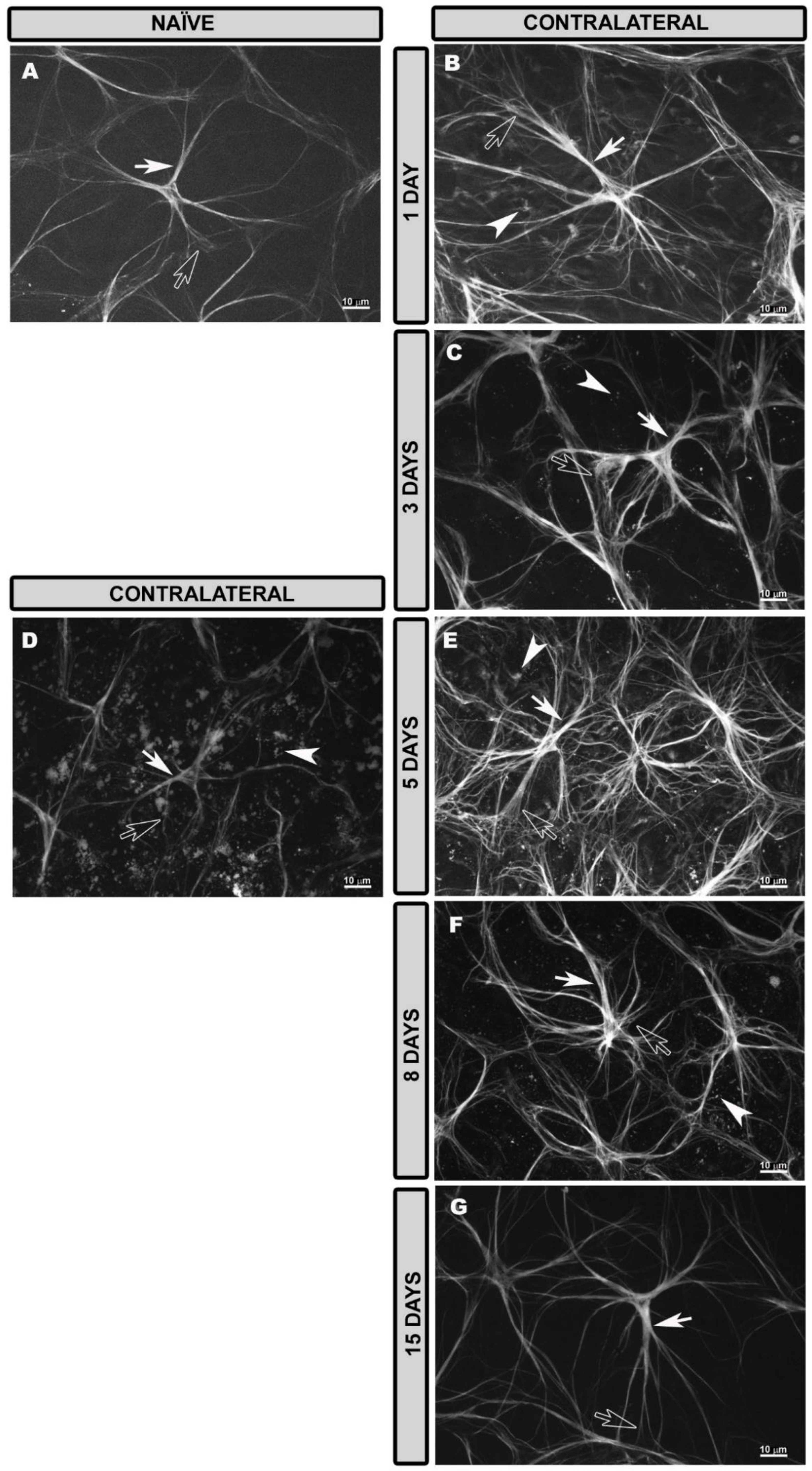 Biomedicines | Free Full-Text | Retinal Changes in Astrocytes and  M&uuml;ller Glia in a Mouse Model of Laser-Induced Glaucoma: A Time-Course  Study