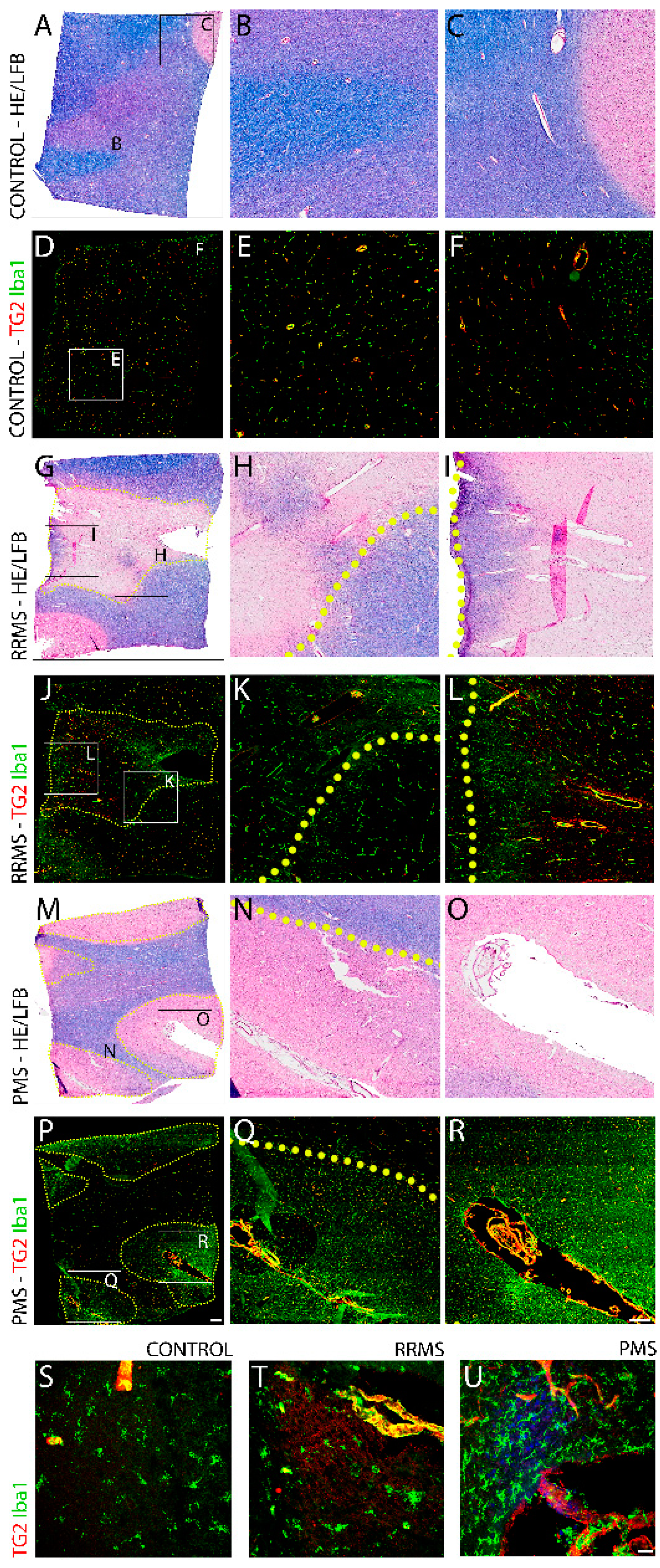Biomedicines 10 01241 g001 Biomedicines 10 01241 g001