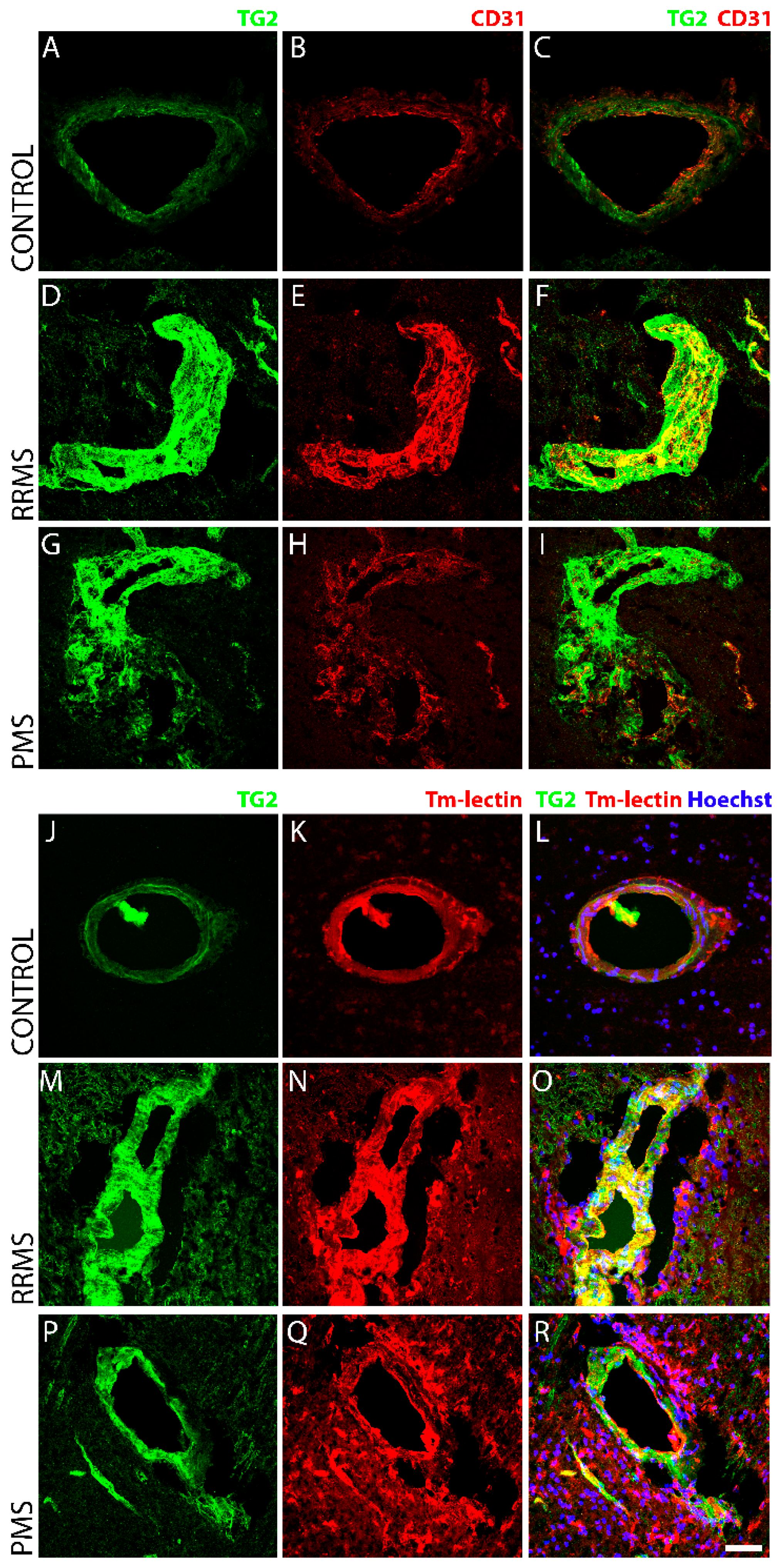 Biomedicines 10 01241 g004 Biomedicines 10 01241 g004