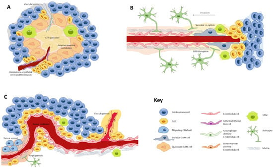 Biomedicines | Free Full-Text | The Vascular Microenvironment in  Glioblastoma: A Comprehensive Review