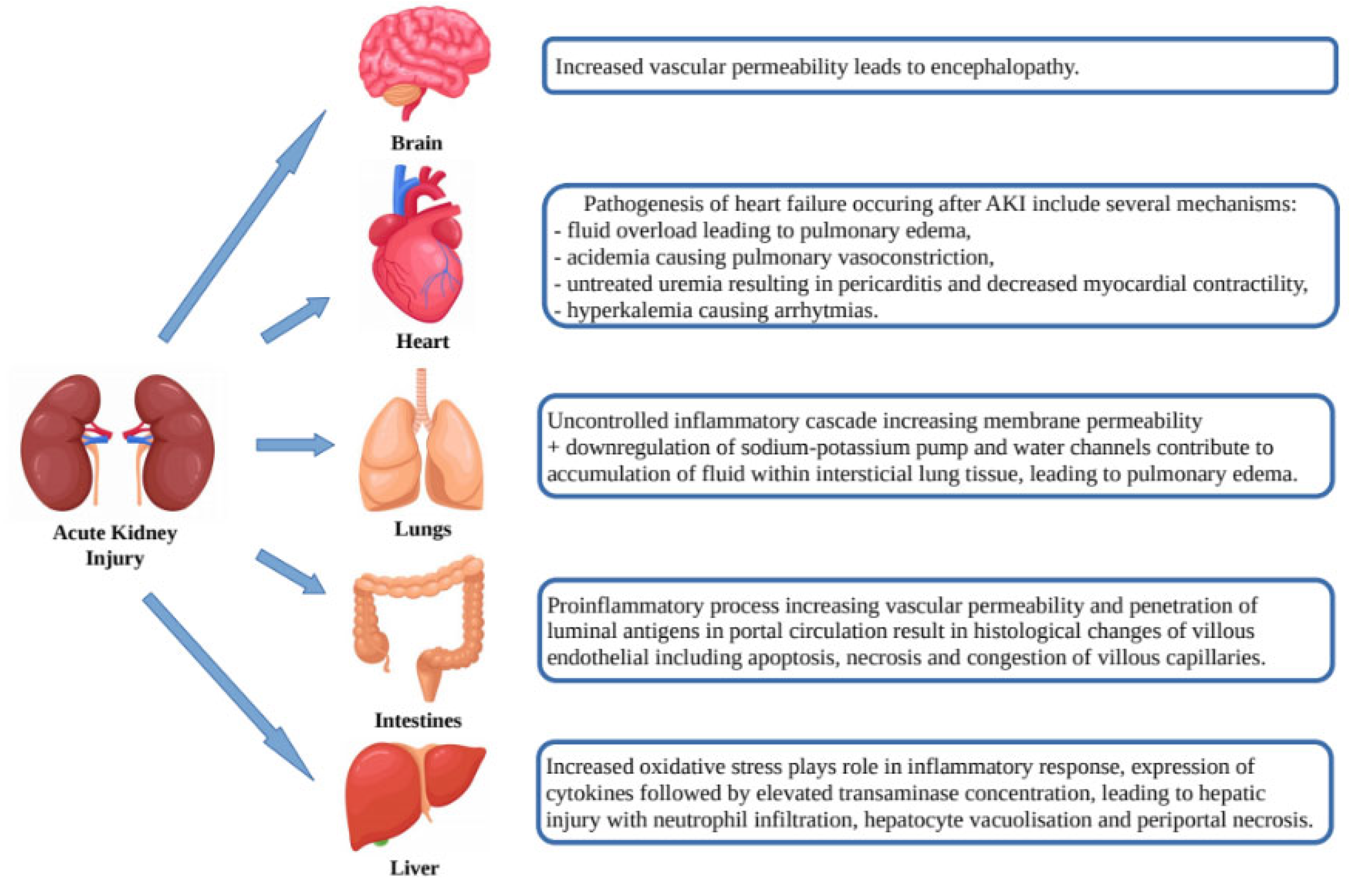 Organ Failure in Patients With Acute MI and Shock Is Prevalent and Rising