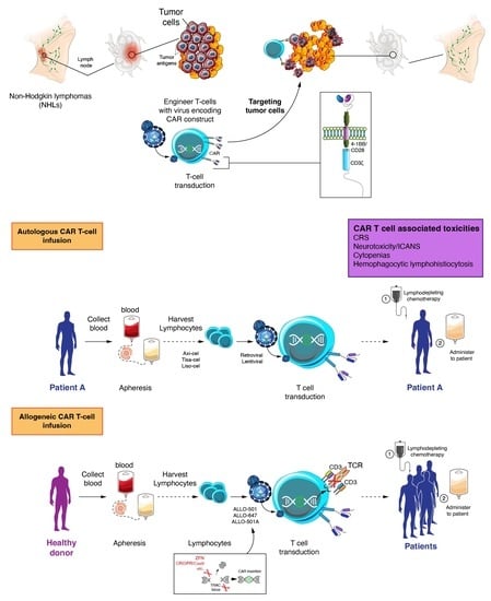 Biomedicines | Free Full-Text | CAR T-Based Therapies in Lymphoma: A ...