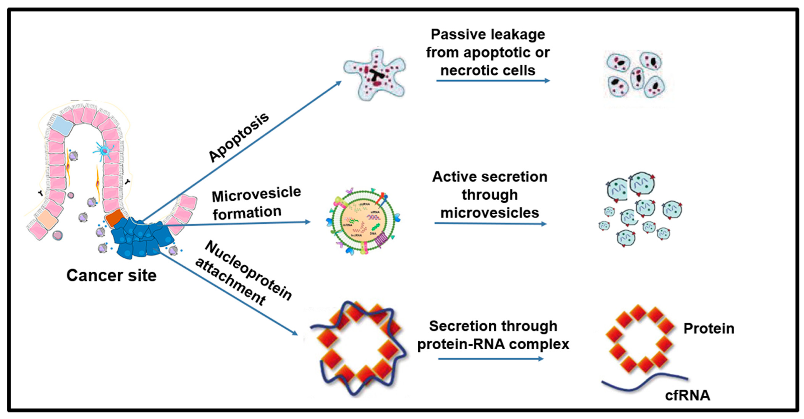 Biomedicines | Free Full-Text | Diagnostic and Therapeutic Potential of ...