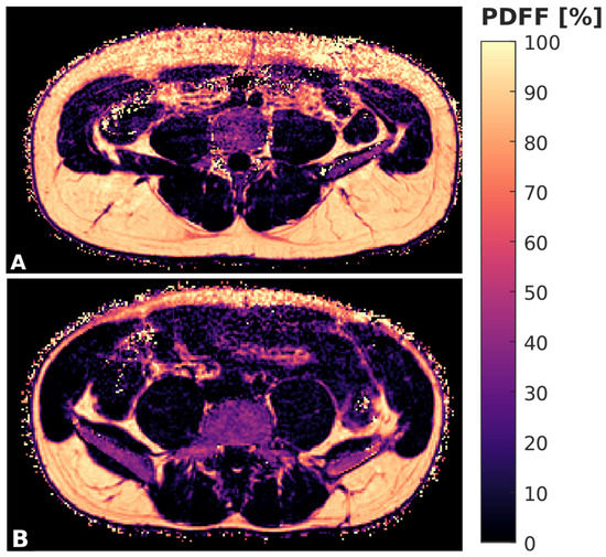 Biomedicines | Free Full-Text | Associations of Texture Features