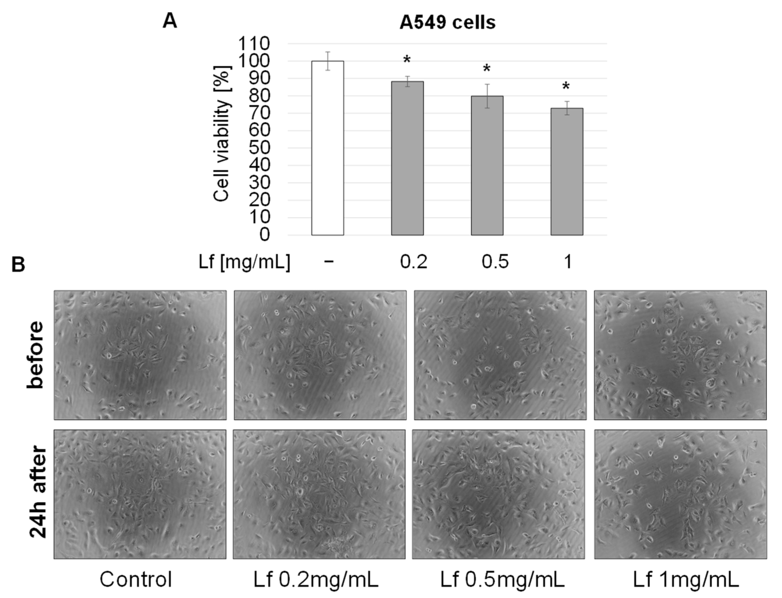 Biomedicines | Free Full-Text | Human Lactoferrin Synergizes with Etoposide  to Inhibit Lung Adenocarcinoma Cell Growth While Attenuating  Etoposide-Mediated Cytotoxicity of Human Endothelial Cells