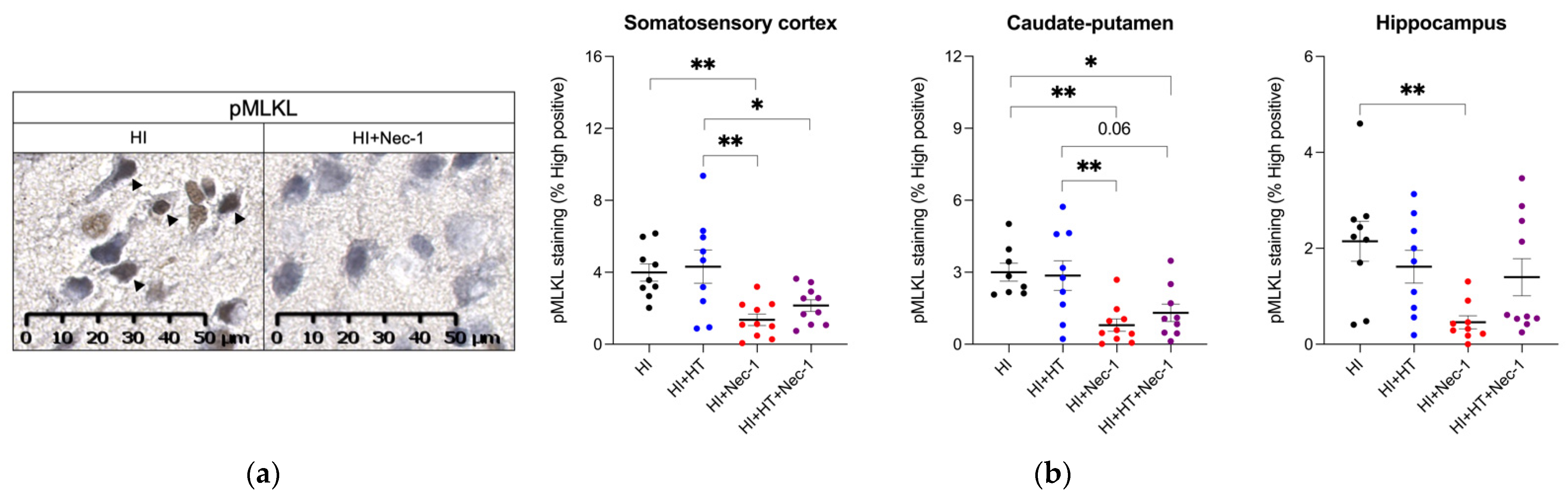 Biomedicines 10 02913 g003 Biomedicines 10 02913 g003