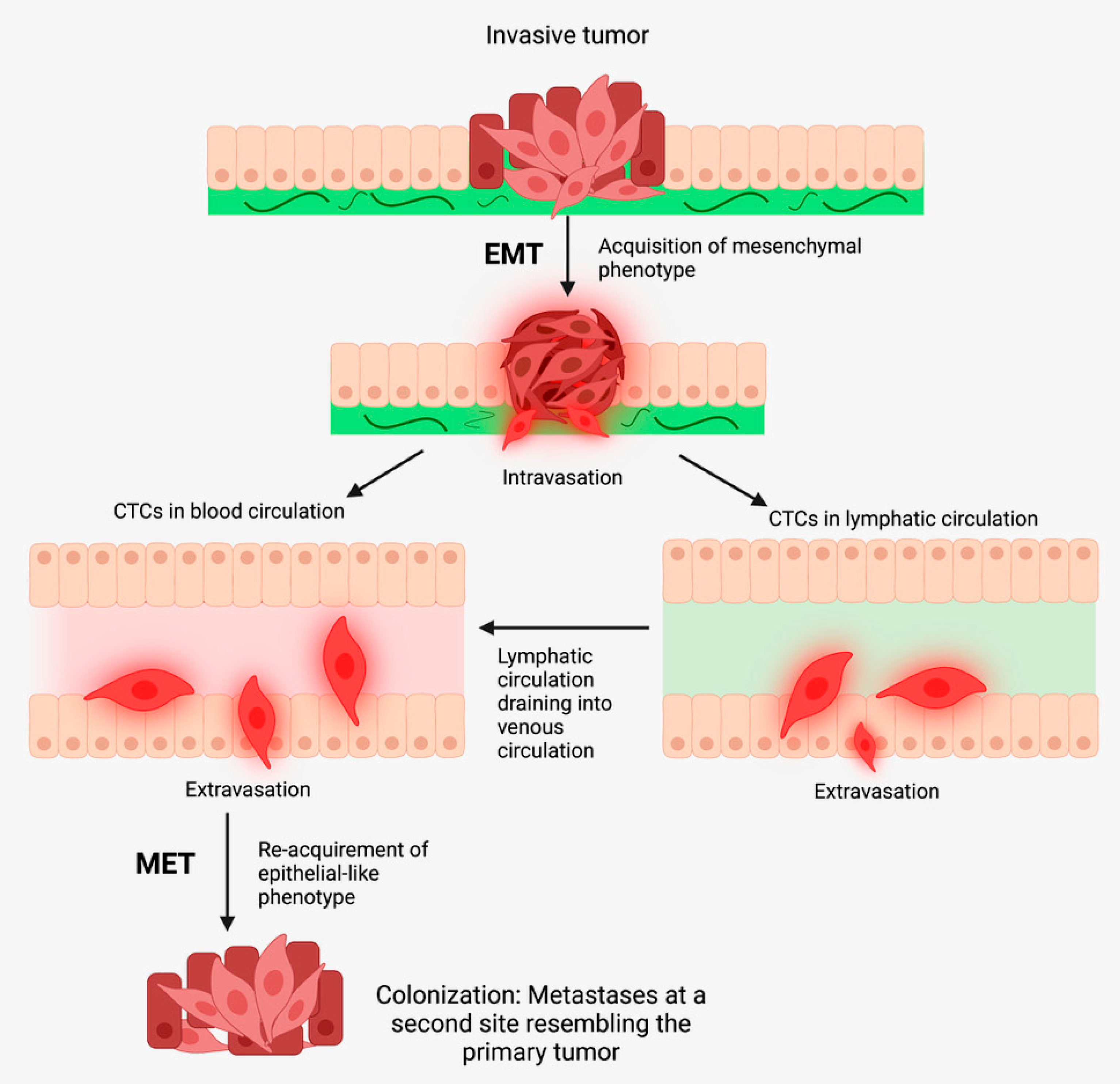 Biomedicines | Free Full-Text | Cancer Metastasis And Treatment ...