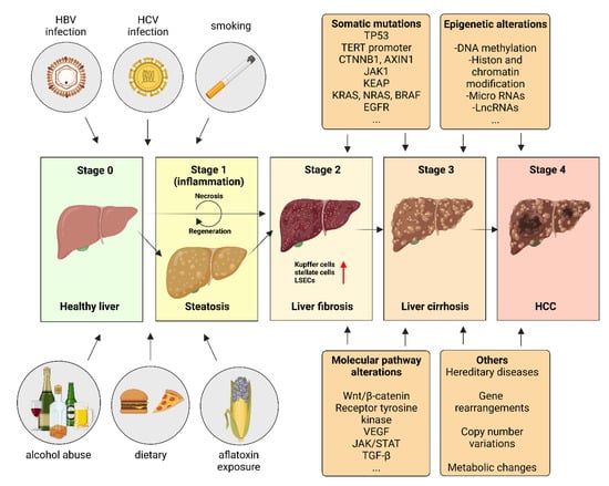 Biomedicines Free Full Text Pathogenesis And Current Treatment Strategies Of Hepatocellular 7092