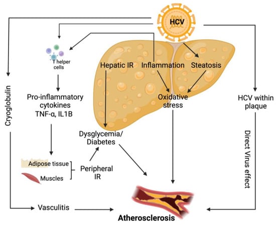 Biomedicines Free Full Text Hepatitis C Virus Lipid Interplay Pathogenesis And Clinical Impact