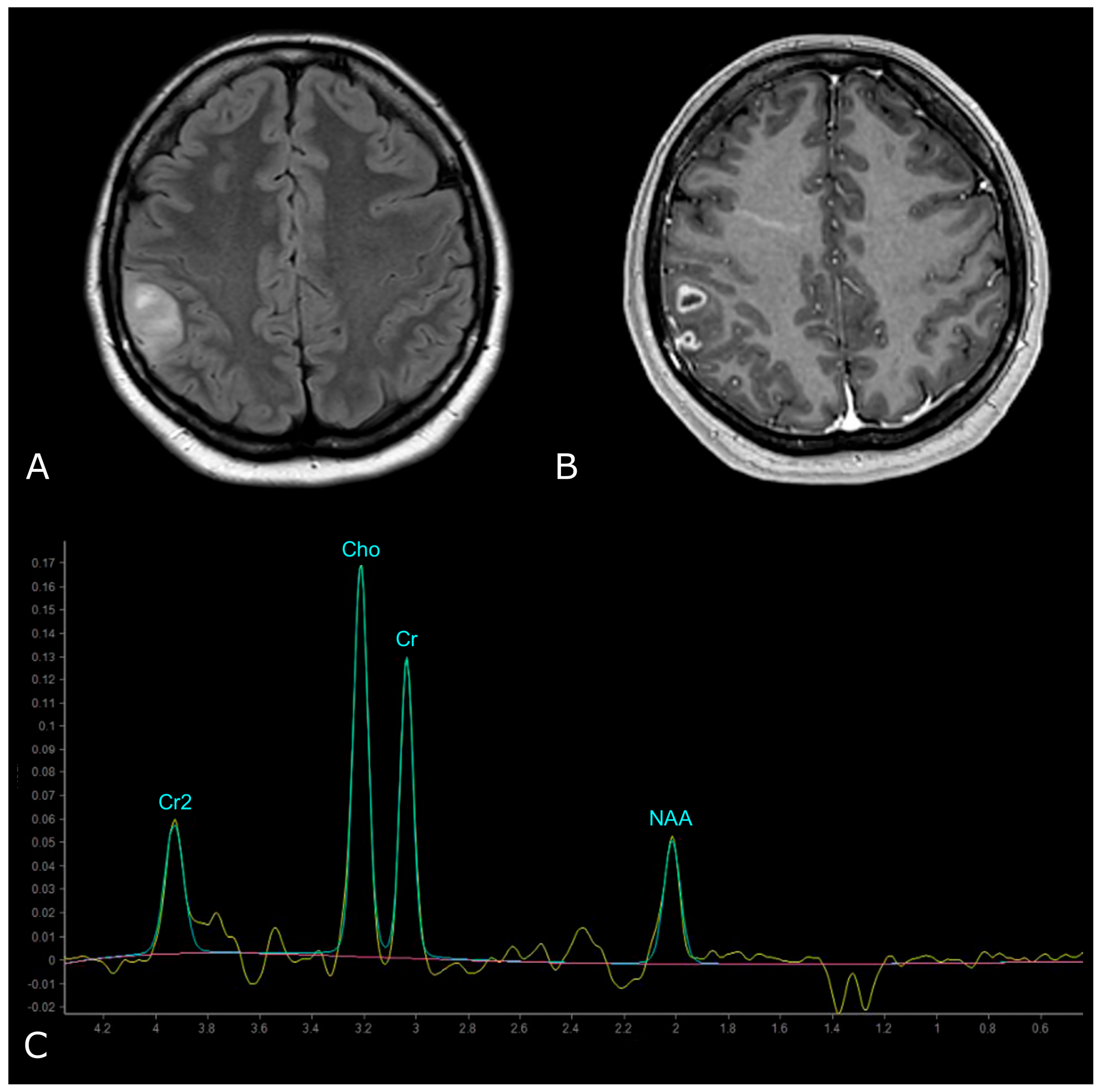 Biomedicines 11 00364 g010 Biomedicines 11 00364 g010