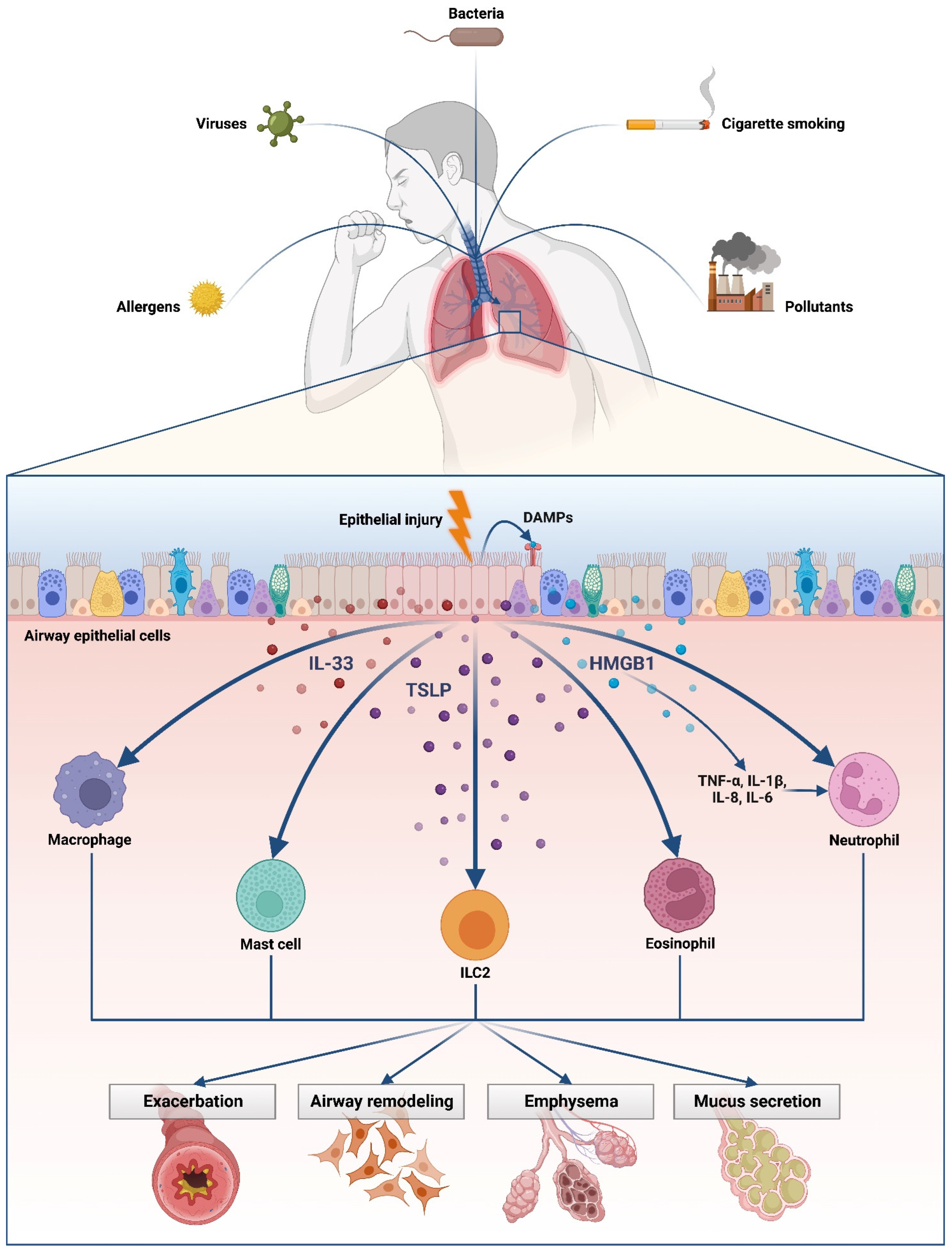 Staphylococcus aureus Orchestrates Type 2 Airway Diseases: Trends in  Molecular Medicine