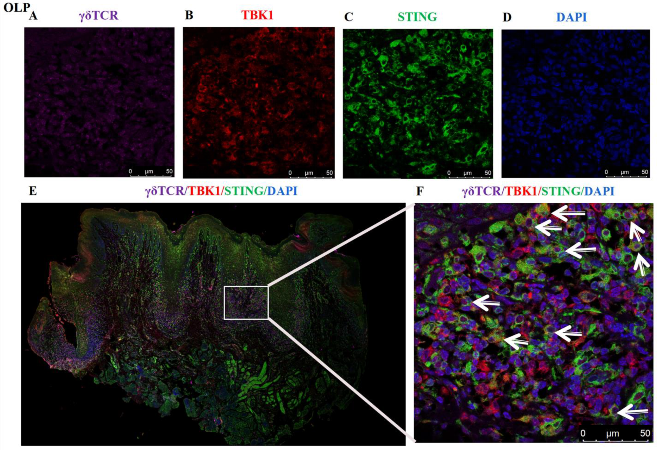 Biomedicines 11 00955 g005 Biomedicines 11 00955 g005