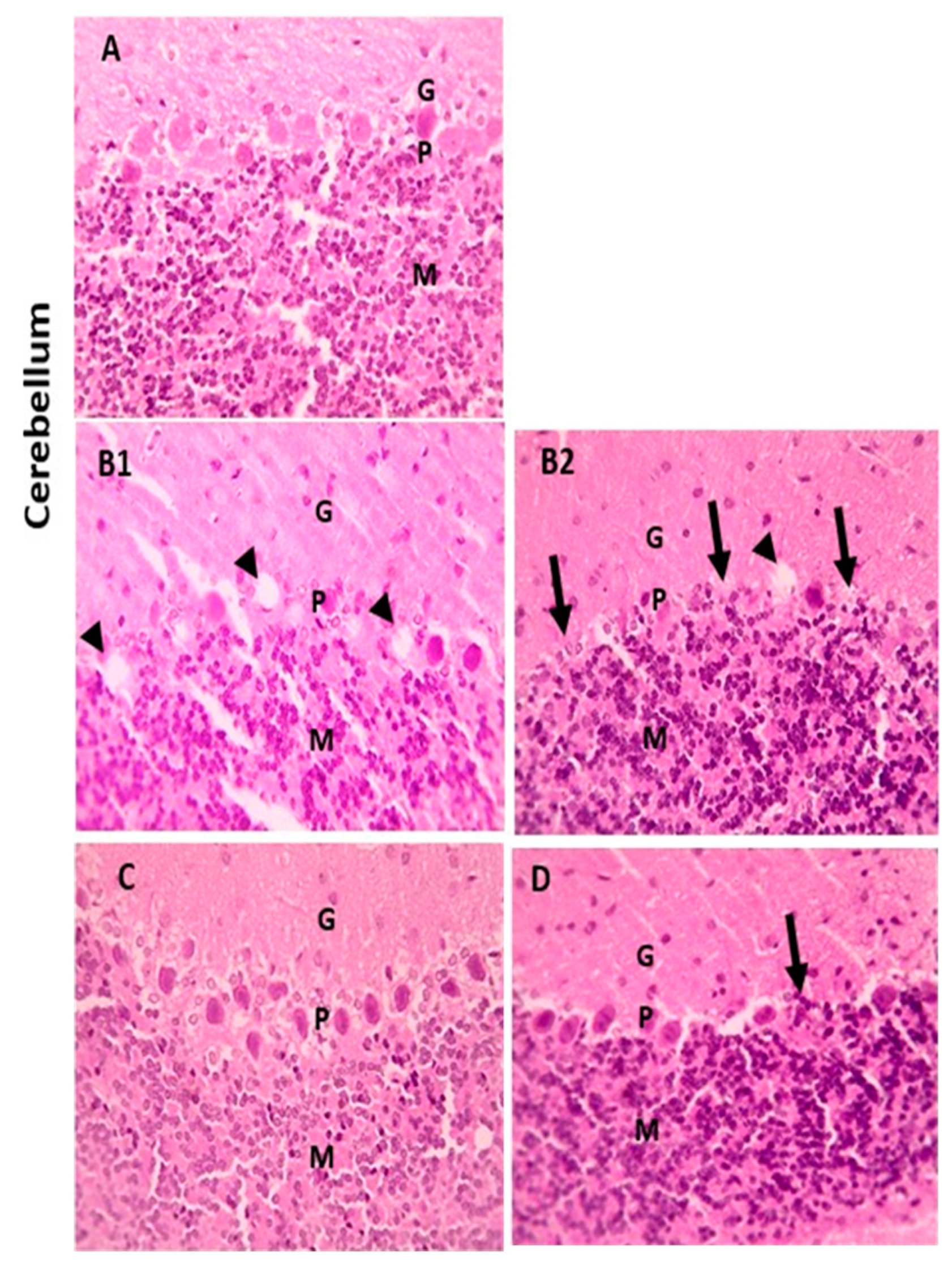 PDF) Mechanism of the negative inotropic effect of naringin in mouse heart., [Mecanismo del efecto inotrópico negativo de la naringina en el corazón de  ratón]