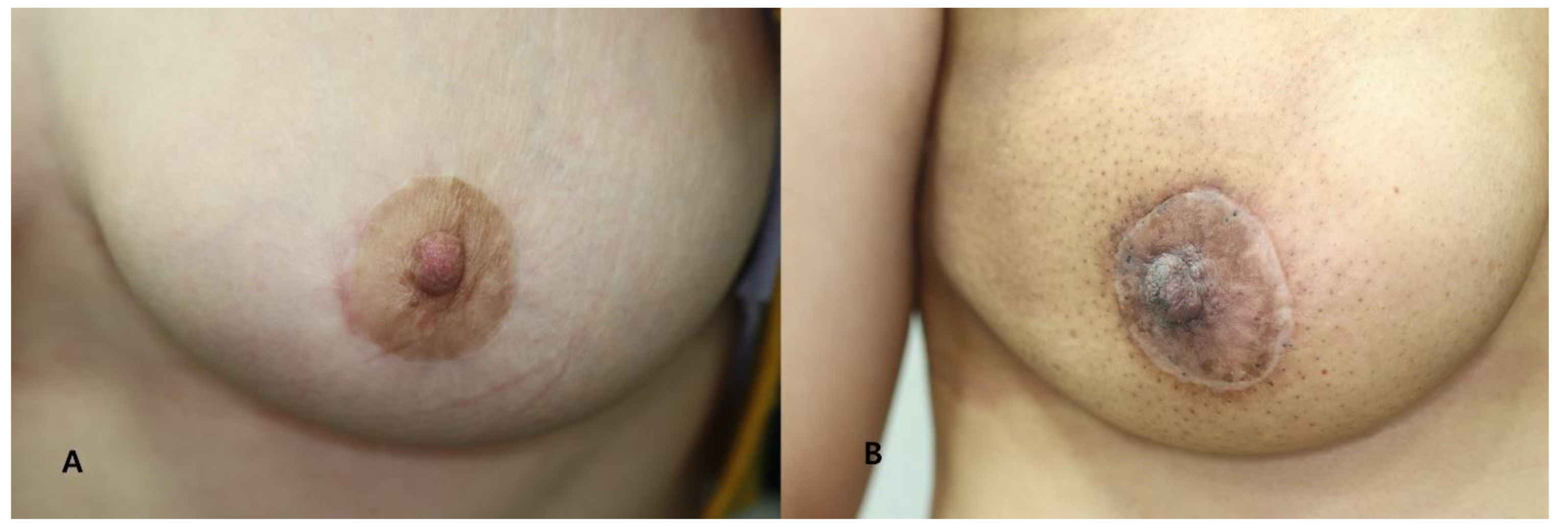 Biomedicines 11 01089 g004