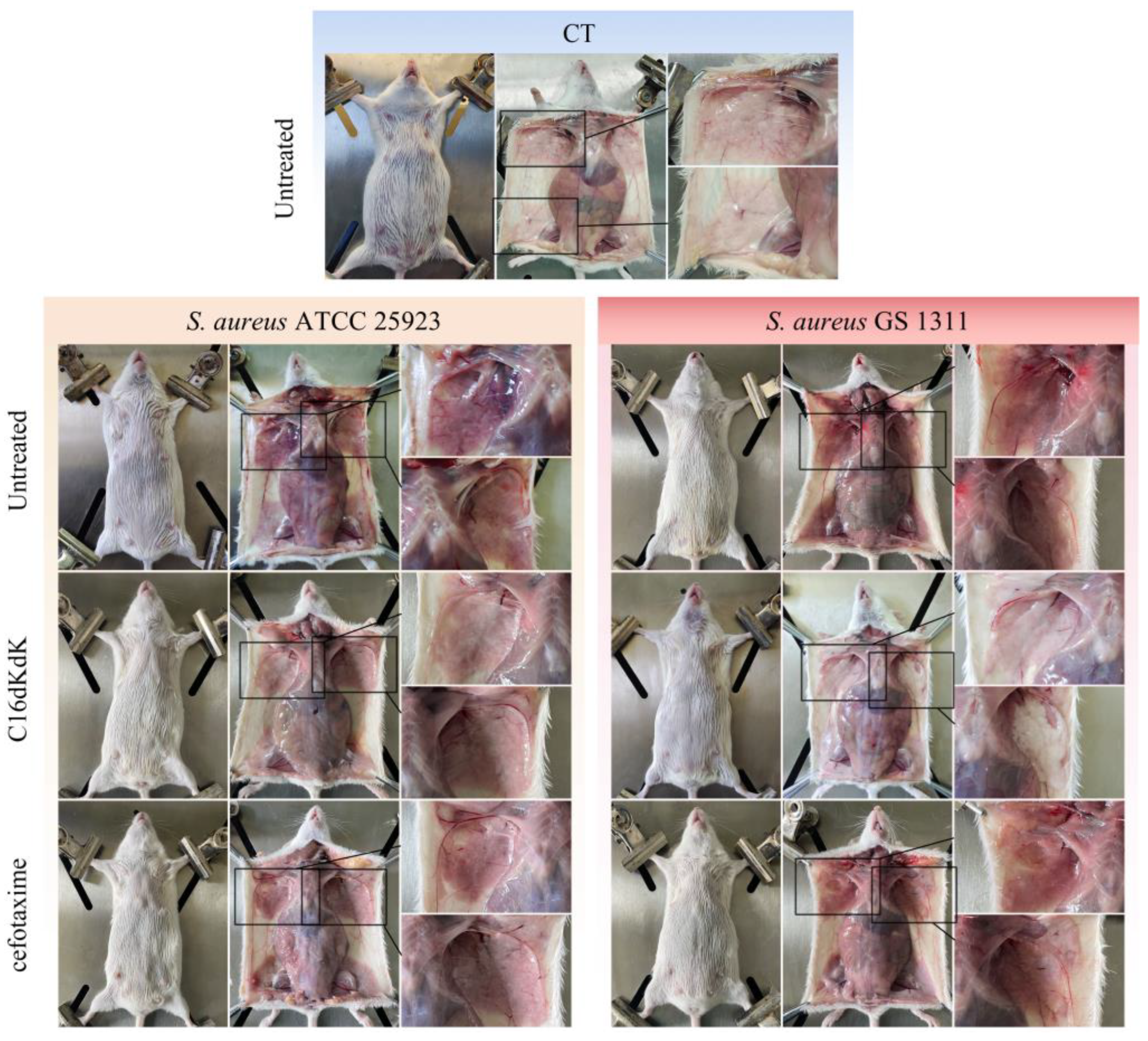 Biomedicines 11 01188 g004 Biomedicines 11 01188 g004