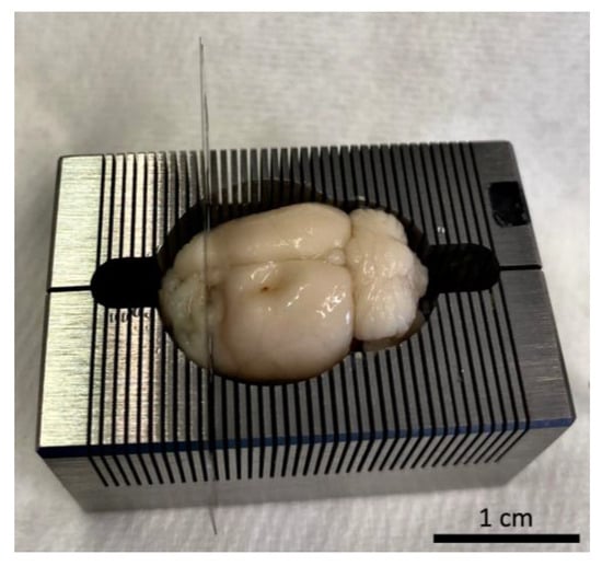 https://www.mdpi.com/biomedicines/biomedicines-11-01518/article_deploy/html/images/biomedicines-11-01518-g008-550.jpg