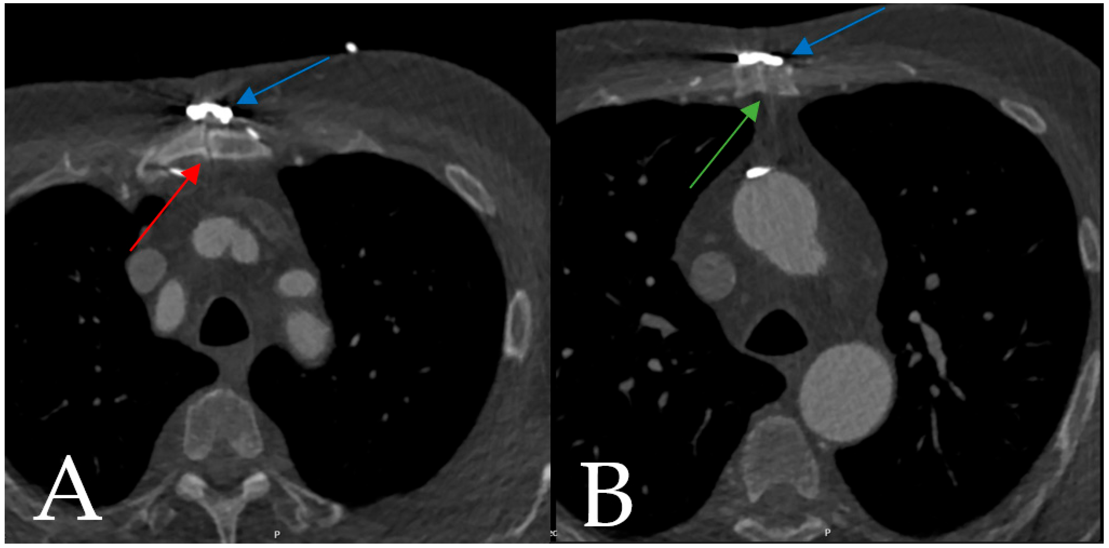 Biomedicines 11 01946 g003 Biomedicines 11 01946 g003
