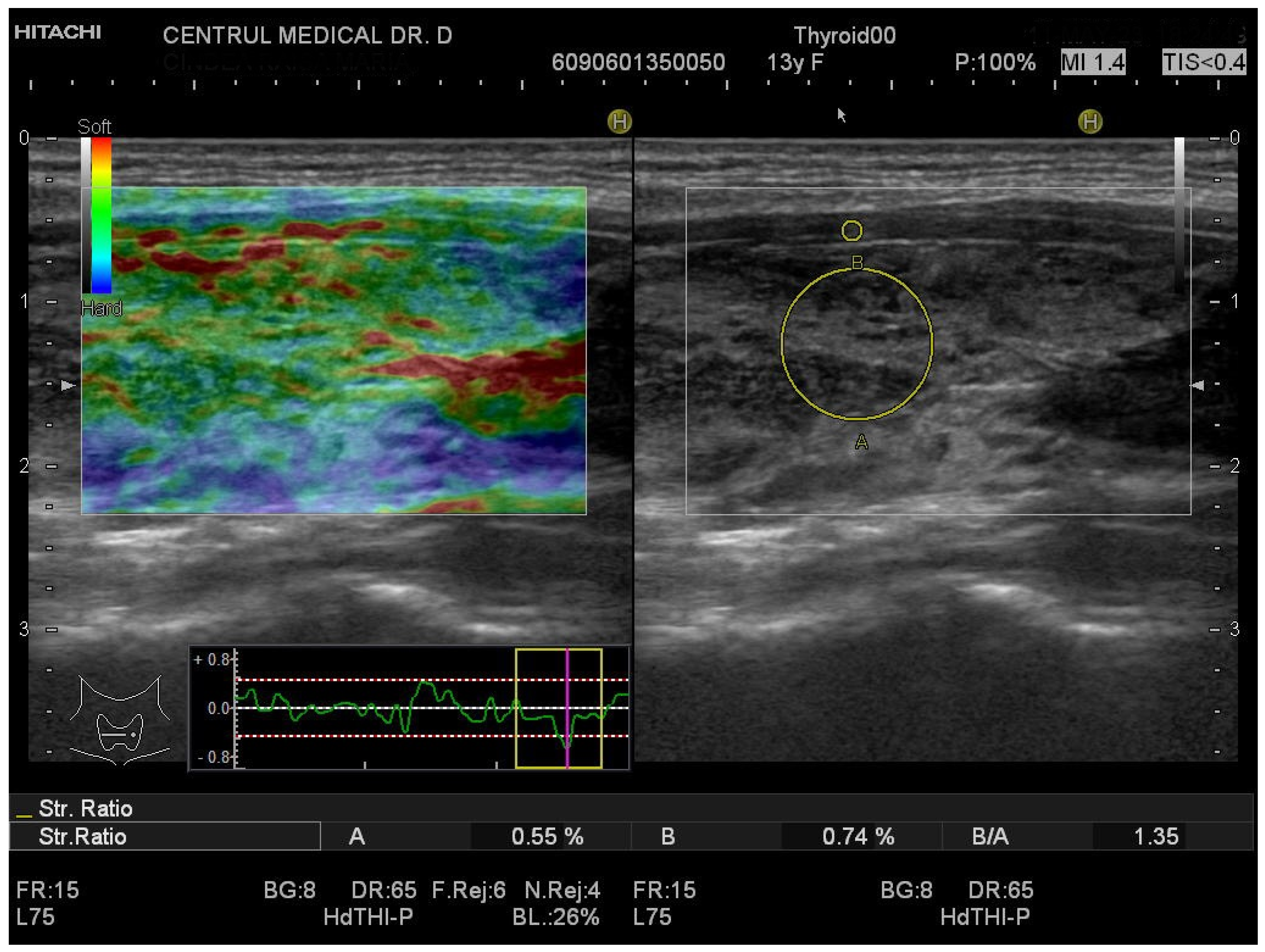 Biomedicines 11 01970 g004 Biomedicines 11 01970 g004