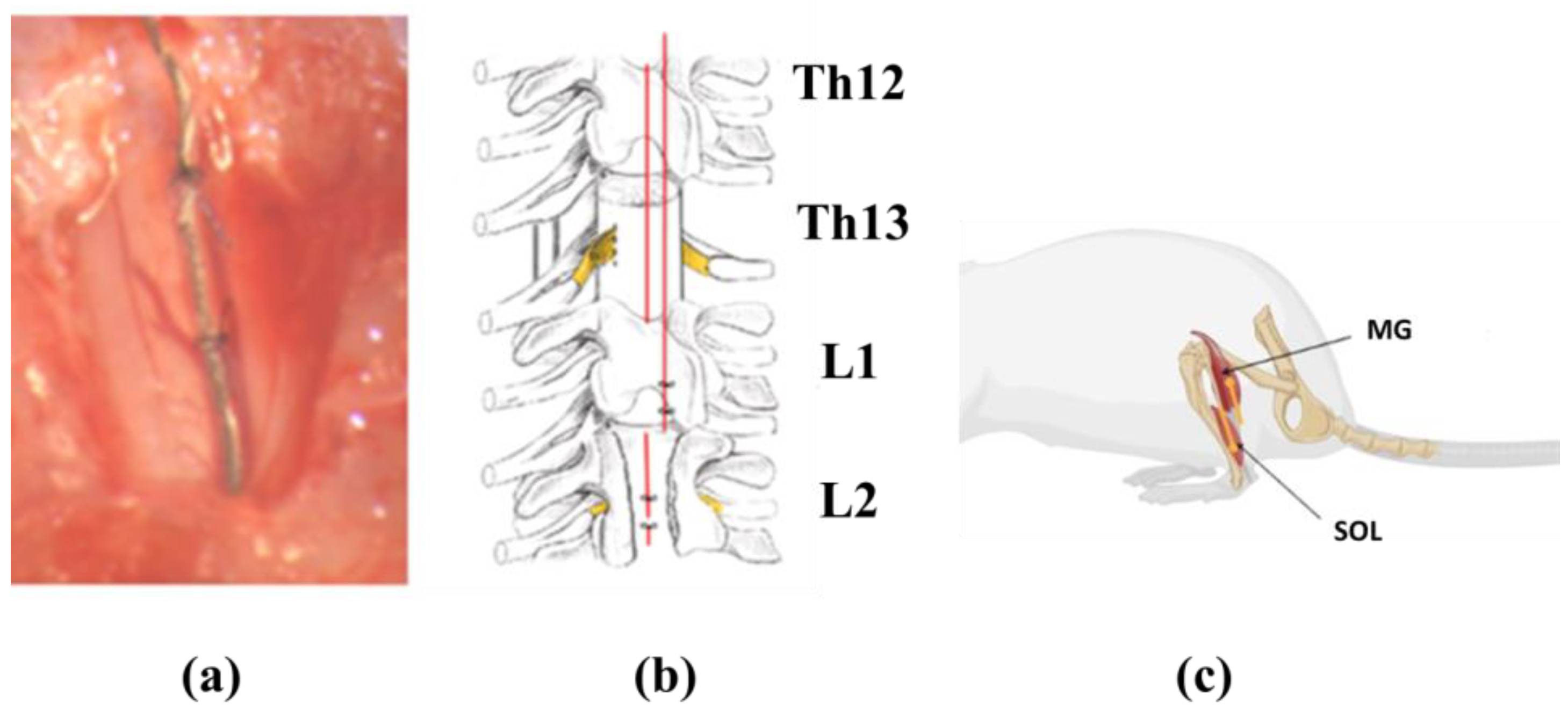 Lumbar Spine Injury L1-L5