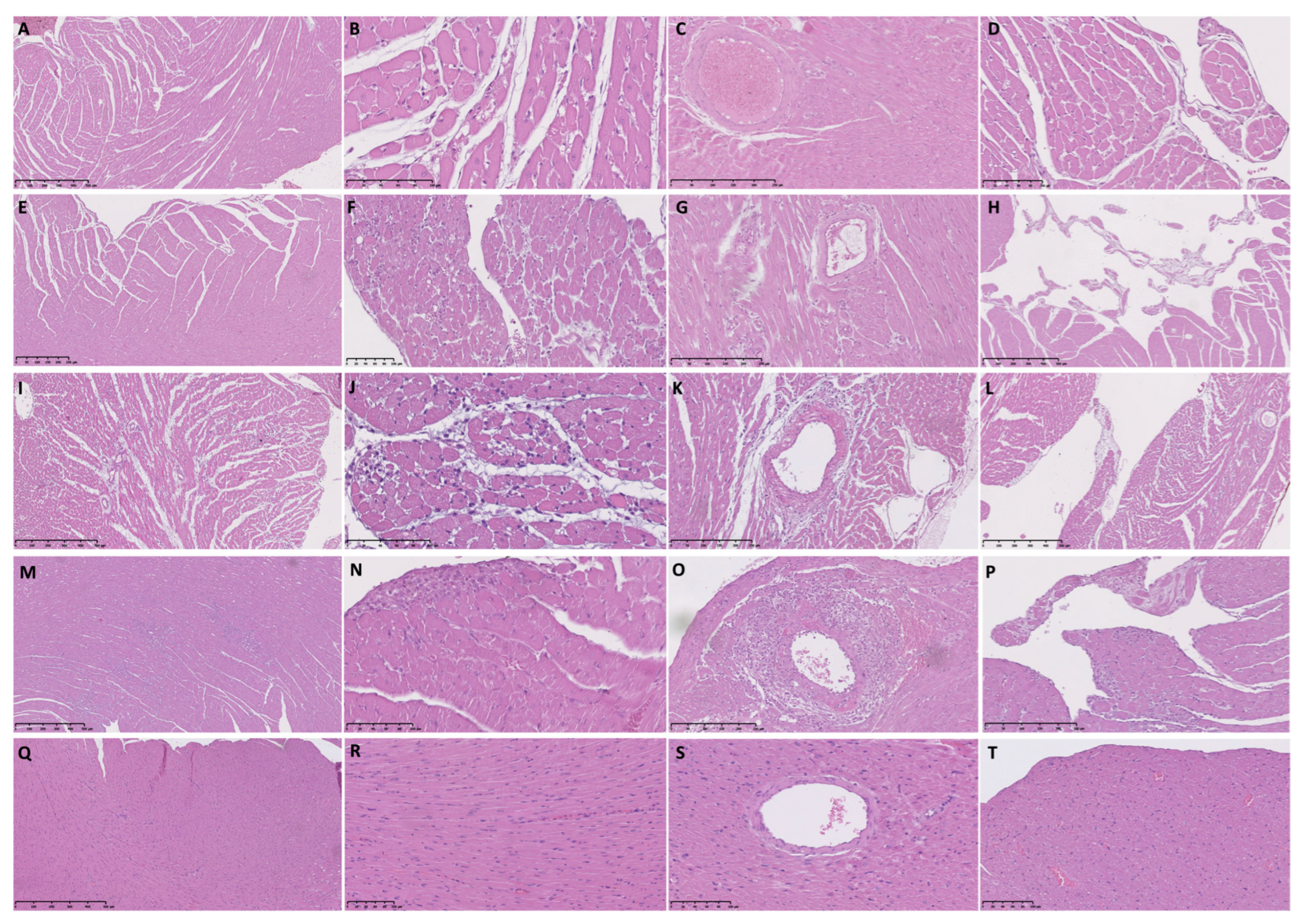 Biomedicines | Free Full-Text | Inflammatory Forms of Cardiomyocyte Cell  Death in the Rat Model of Isoprenaline-Induced Takotsubo Syndrome