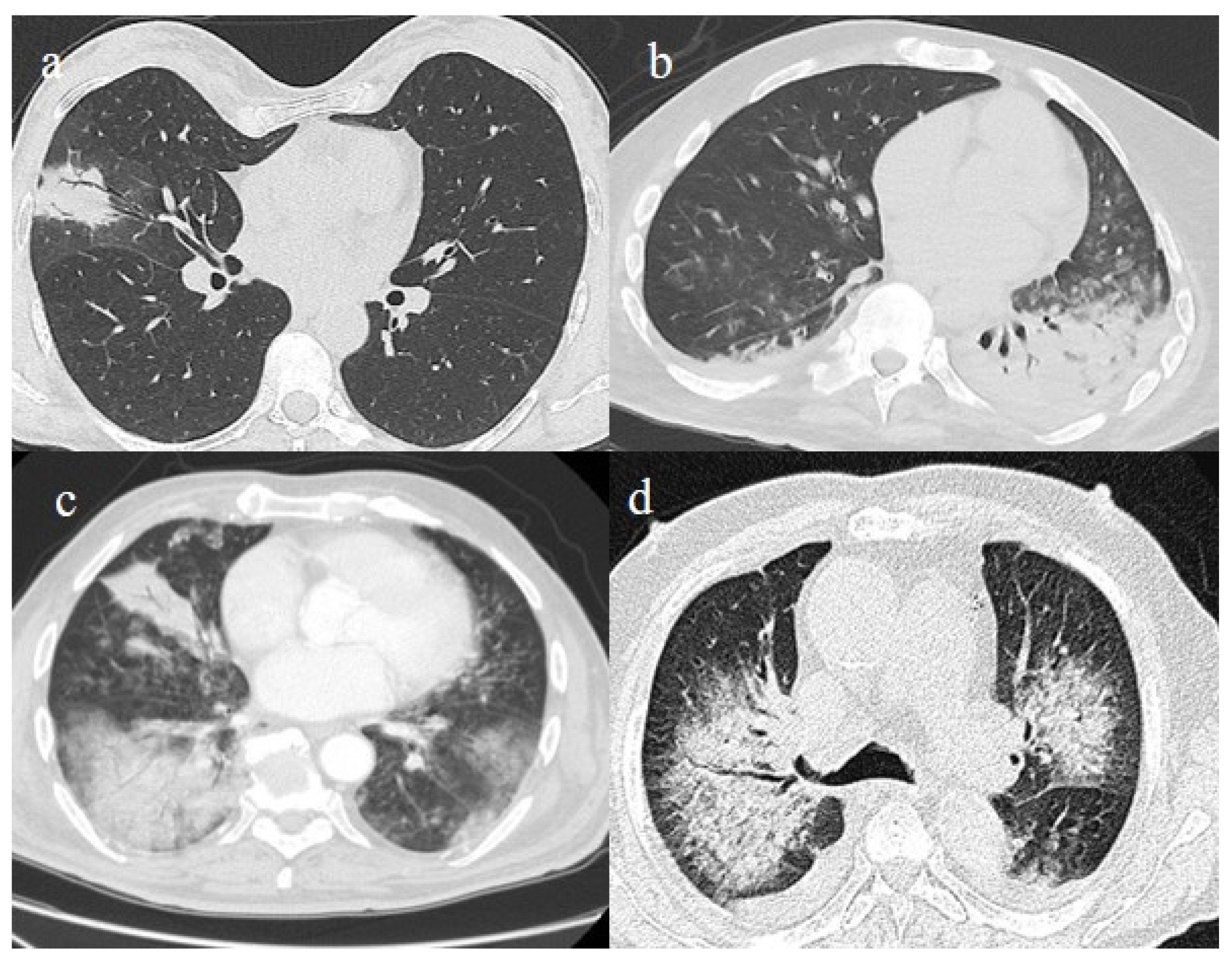 Biomedicines 11 02113 g003 Biomedicines 11 02113 g003