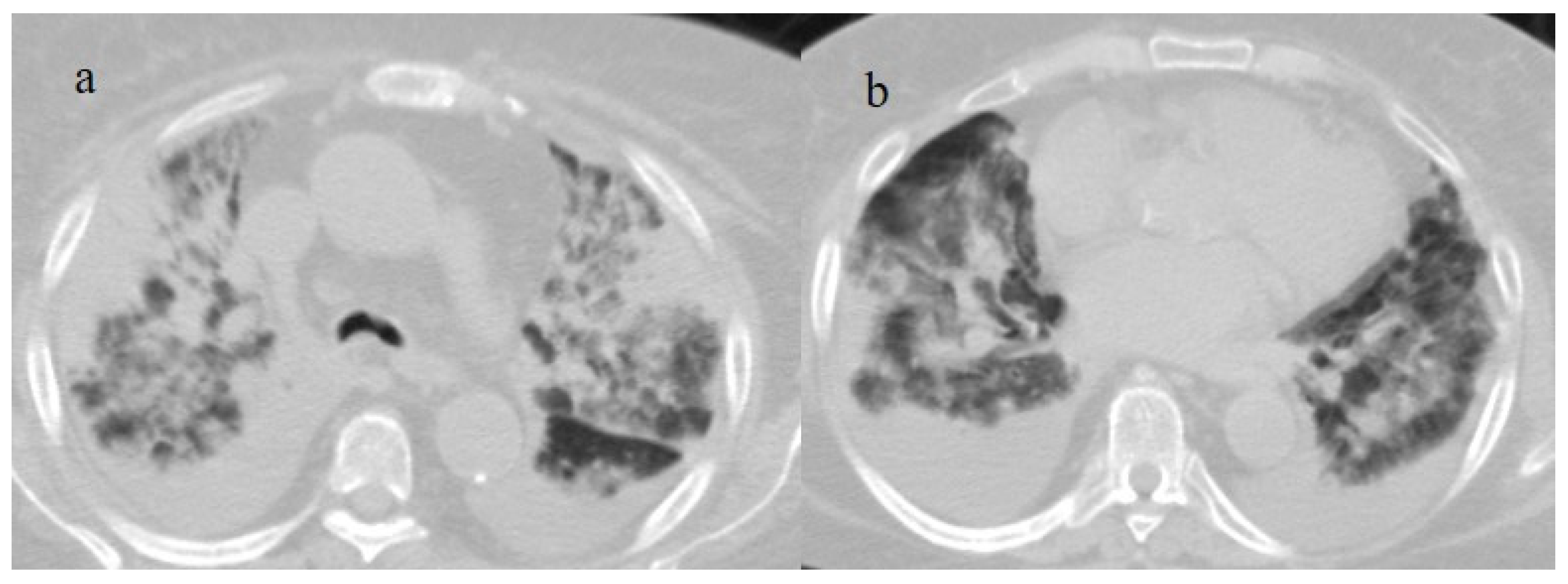 Biomedicines 11 02113 g012 Biomedicines 11 02113 g012