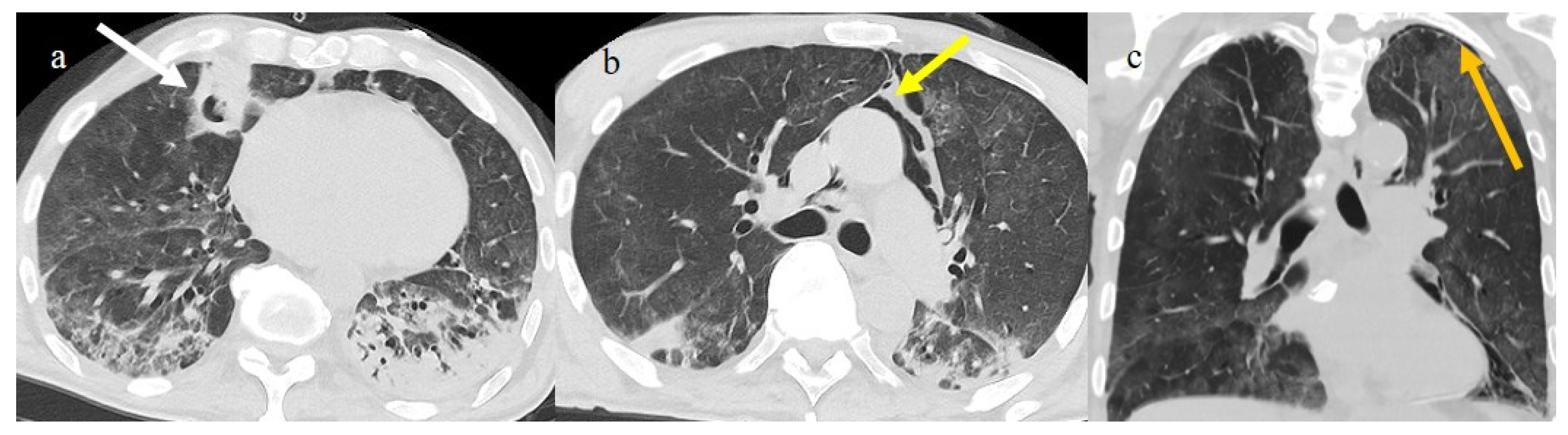 Biomedicines 11 02113 g017 Biomedicines 11 02113 g017