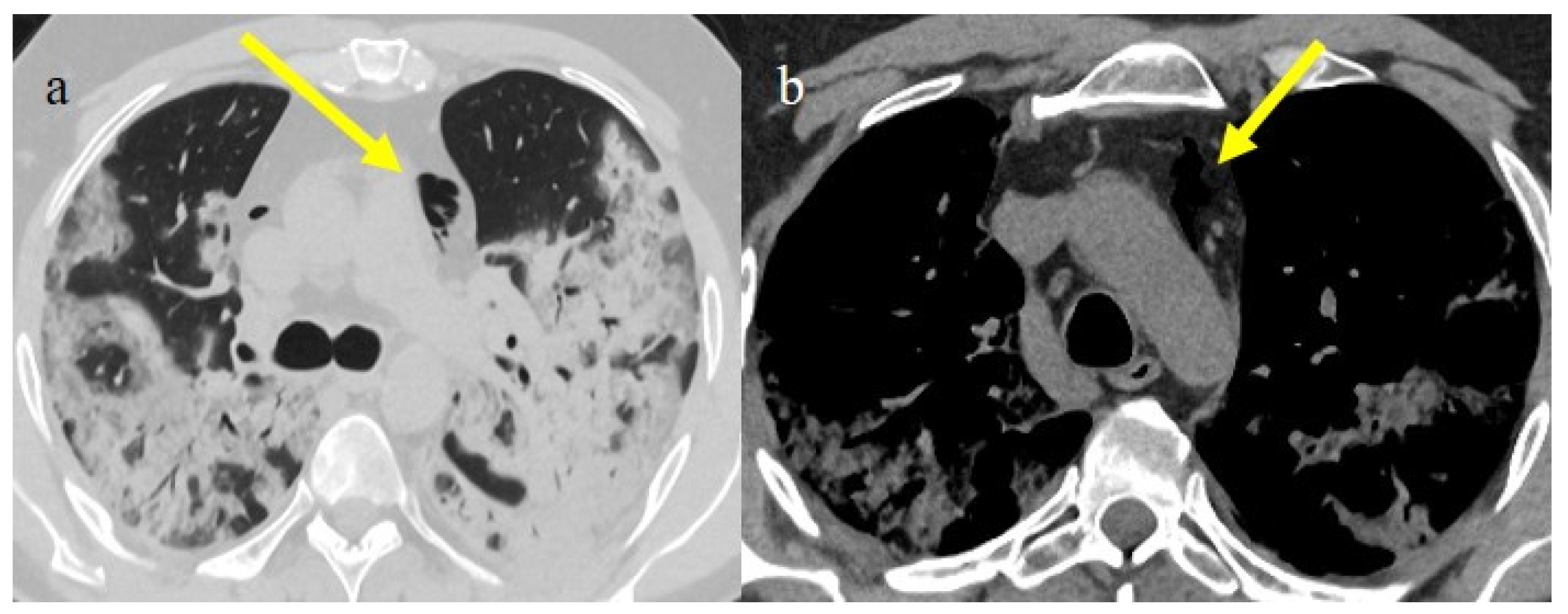 Biomedicines 11 02113 g018 Biomedicines 11 02113 g018