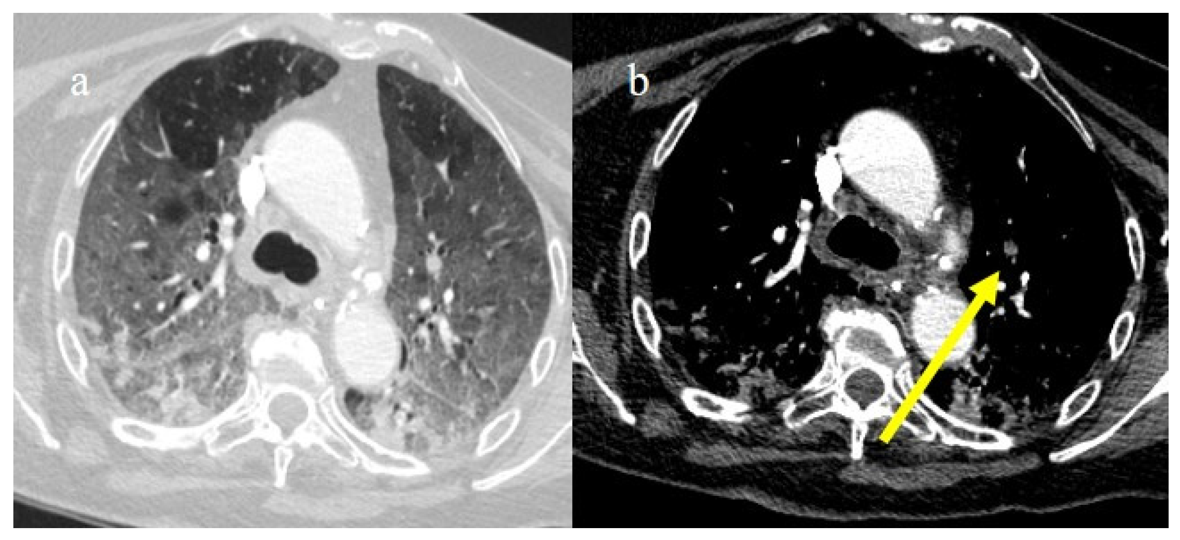 Biomedicines 11 02113 g020 Biomedicines 11 02113 g020