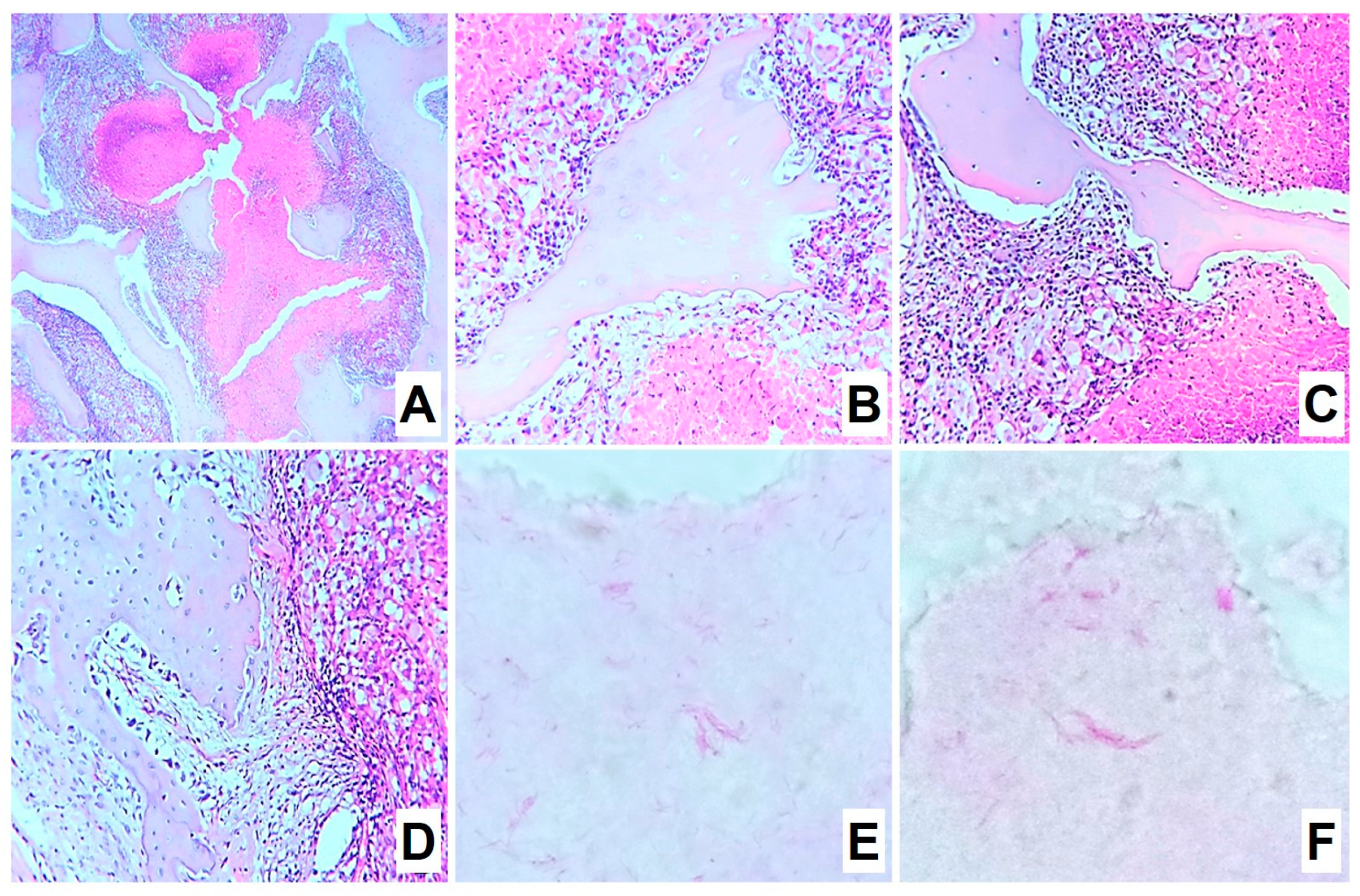 Biomedicines 11 02229 g004 Biomedicines 11 02229 g004