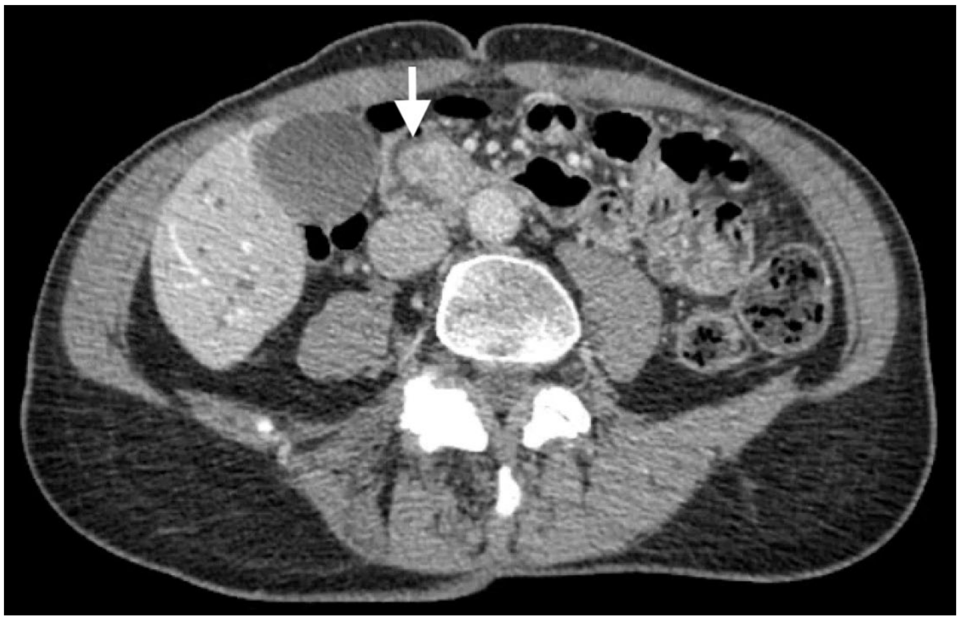 Biomedicines 11 02326 g001