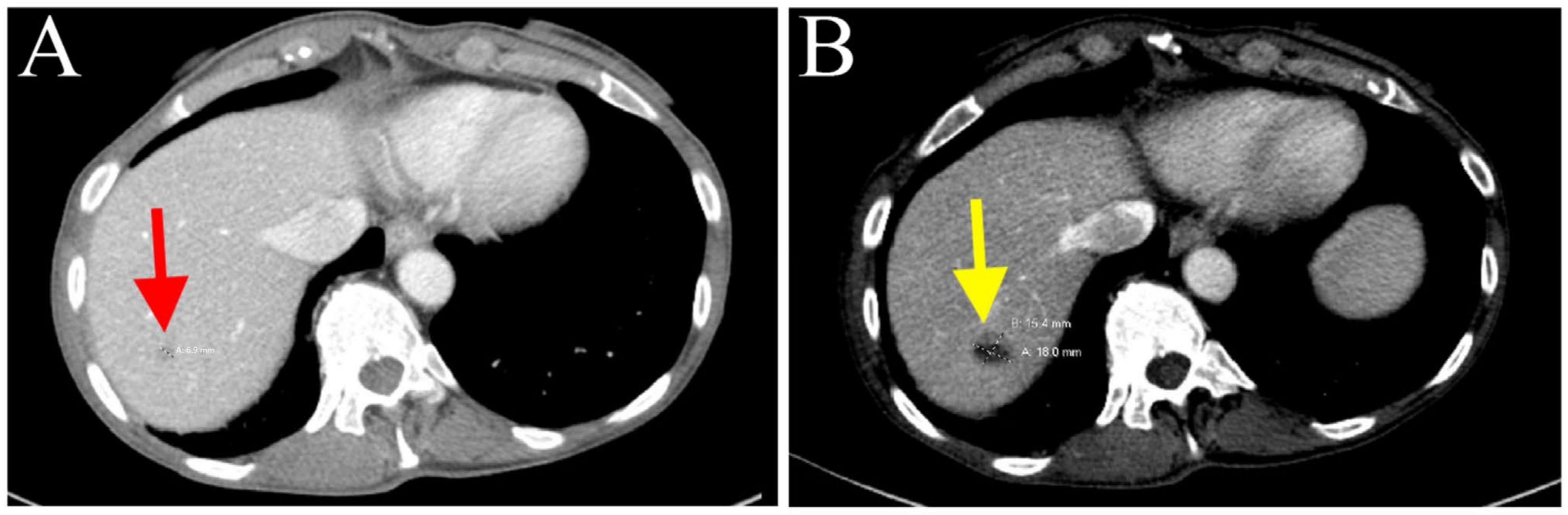 Biomedicines 11 02326 g005