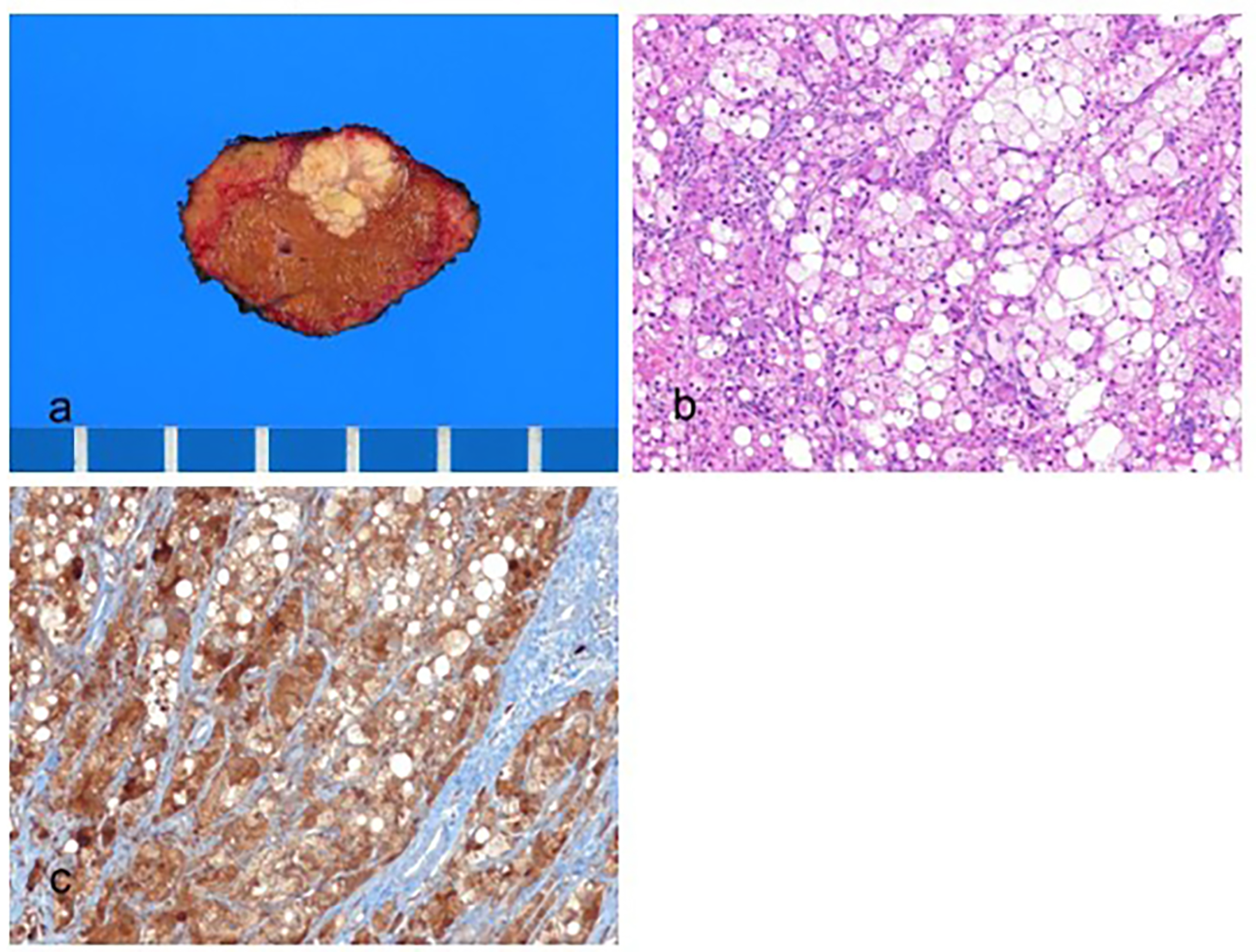 Biomedicines 11 02582 g002 Biomedicines 11 02582 g002