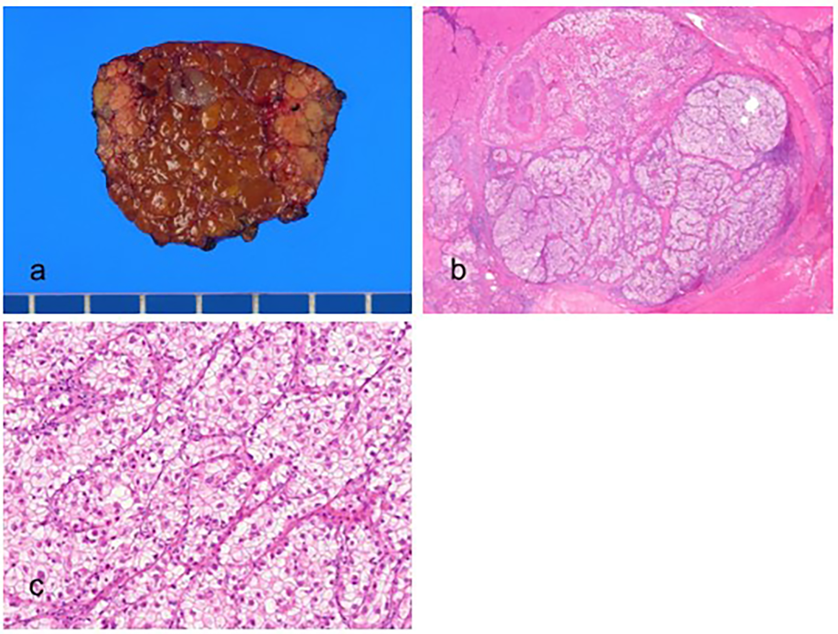 Biomedicines 11 02582 g003 Biomedicines 11 02582 g003