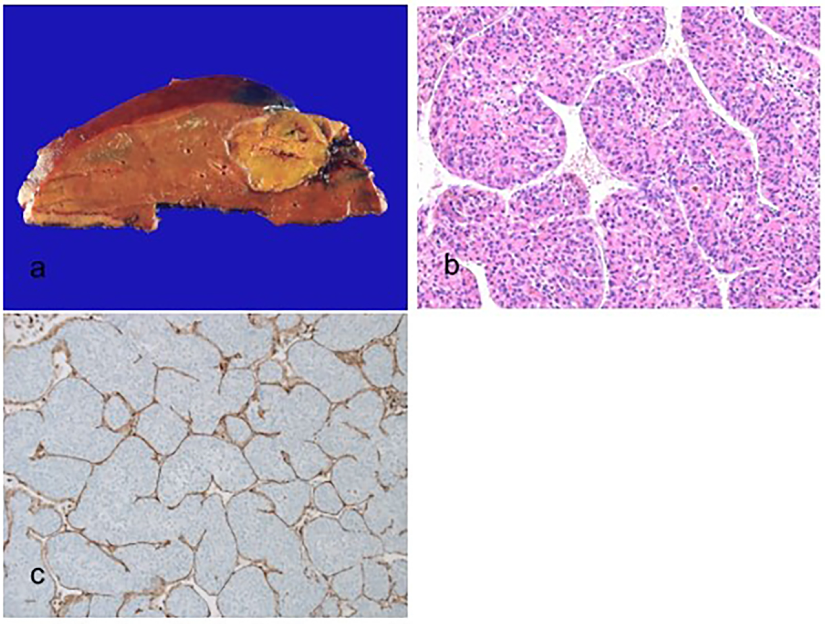 Biomedicines 11 02582 g004 Biomedicines 11 02582 g004