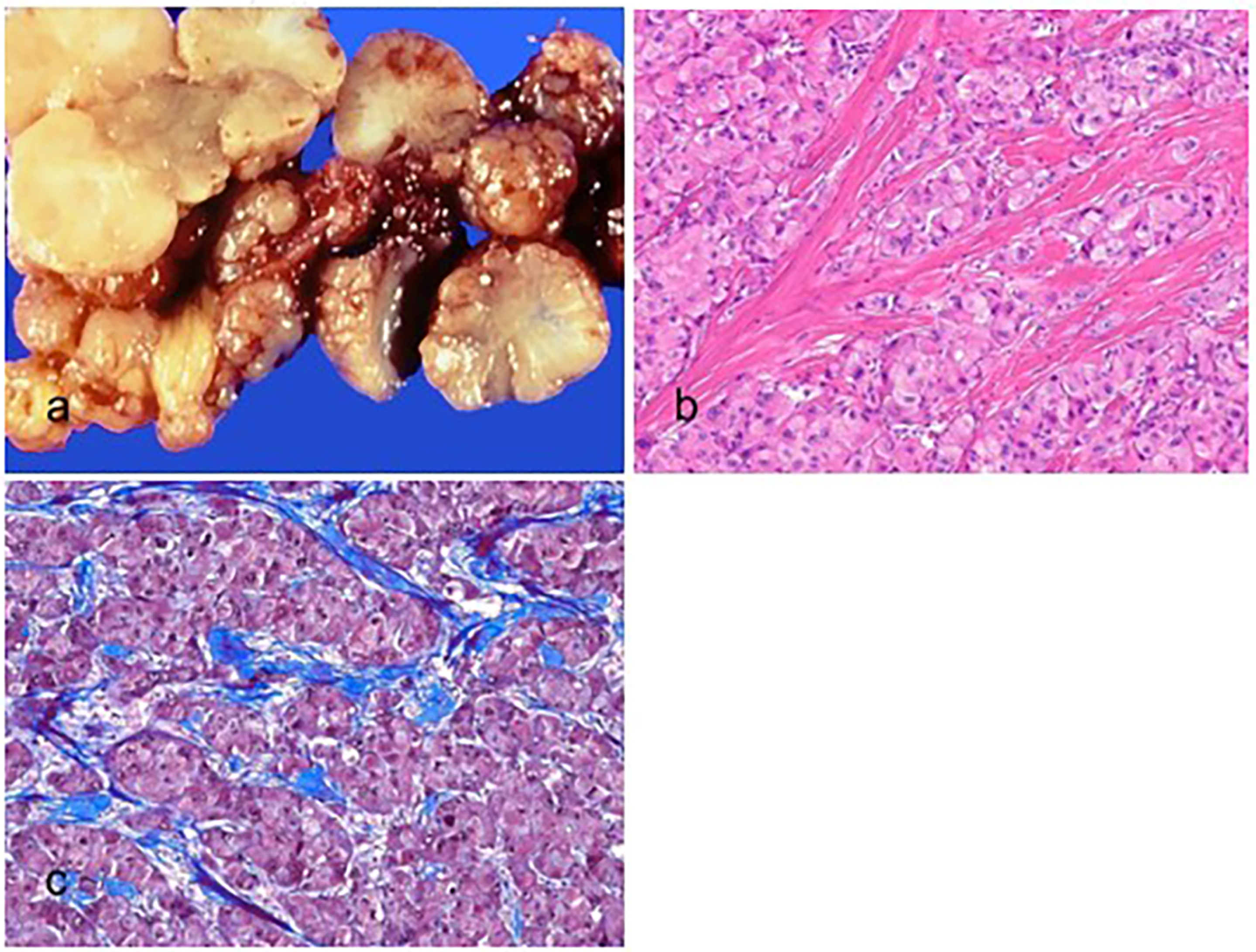 Biomedicines 11 02582 g005 Biomedicines 11 02582 g005