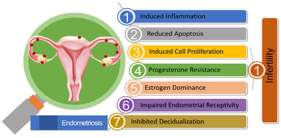 Endometrioma Unveiled: A Comprehensive Review of the Pathogenesis