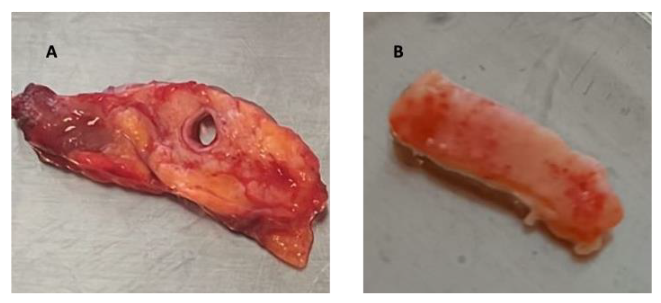 Biomedicines 12 00091 g001 Biomedicines 12 00091 g001