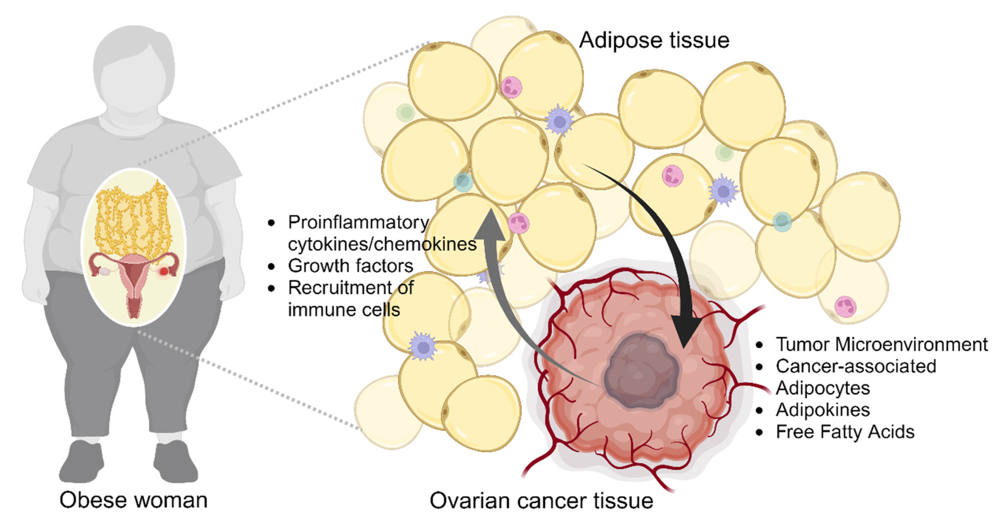 The obese adipose tissue microenvironment in cancer development and  progression