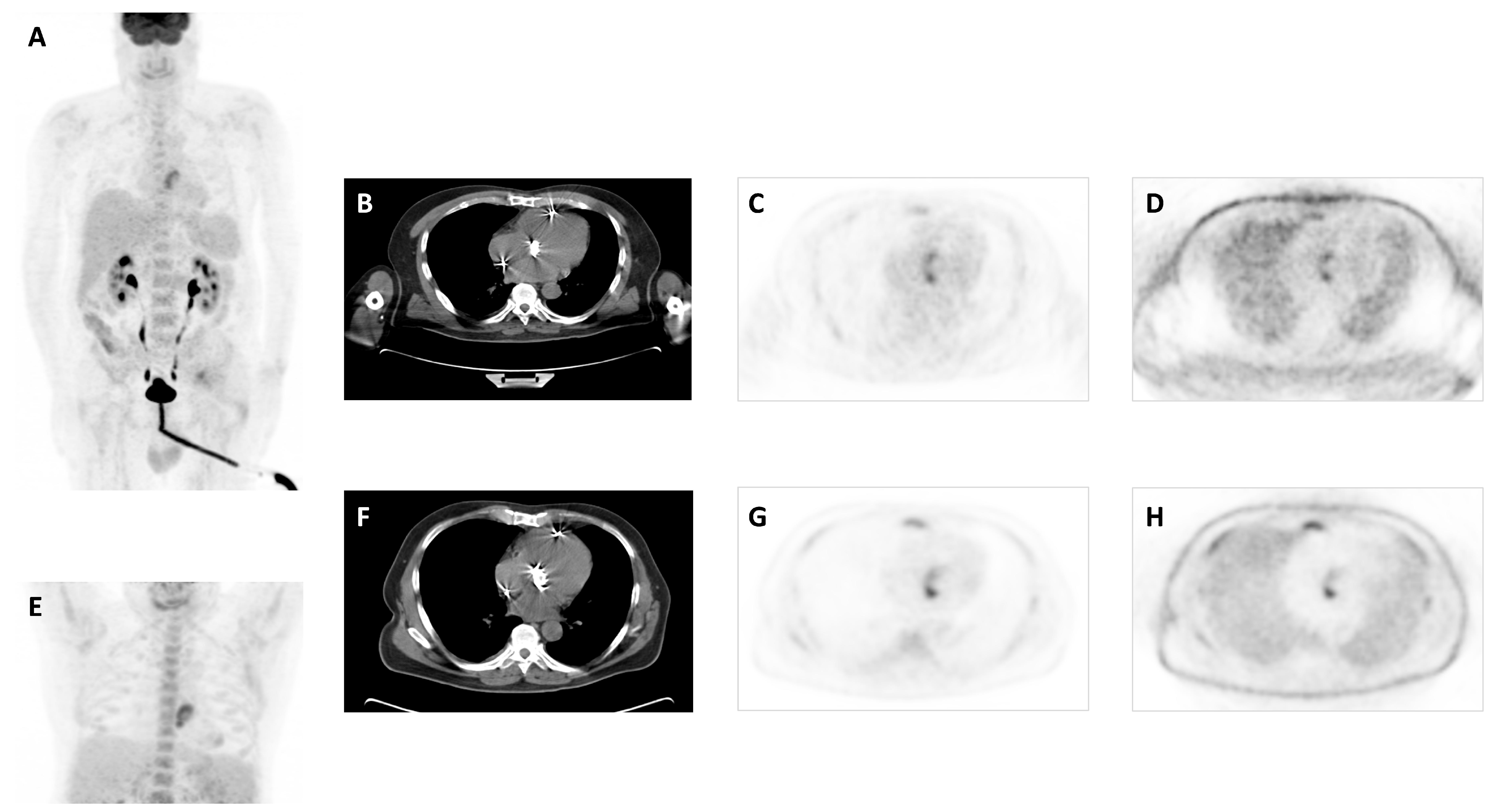 Biomedicines 12 00861 g001