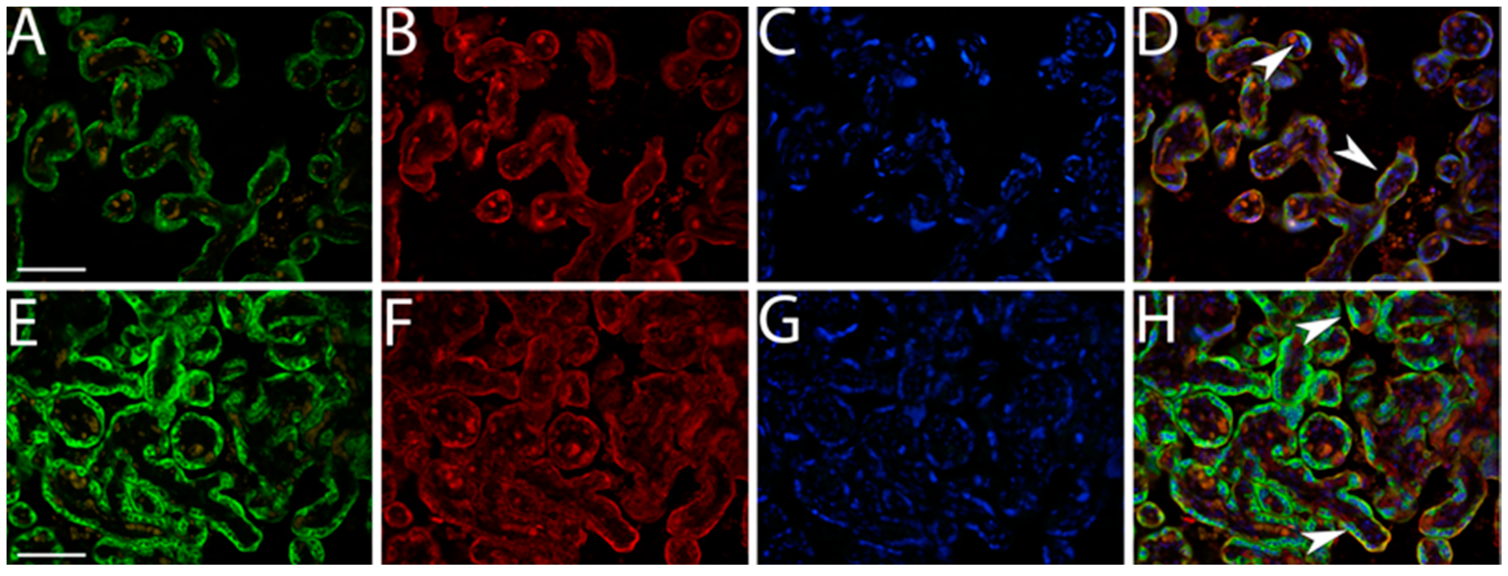 Biomedicines 12 00879 g004