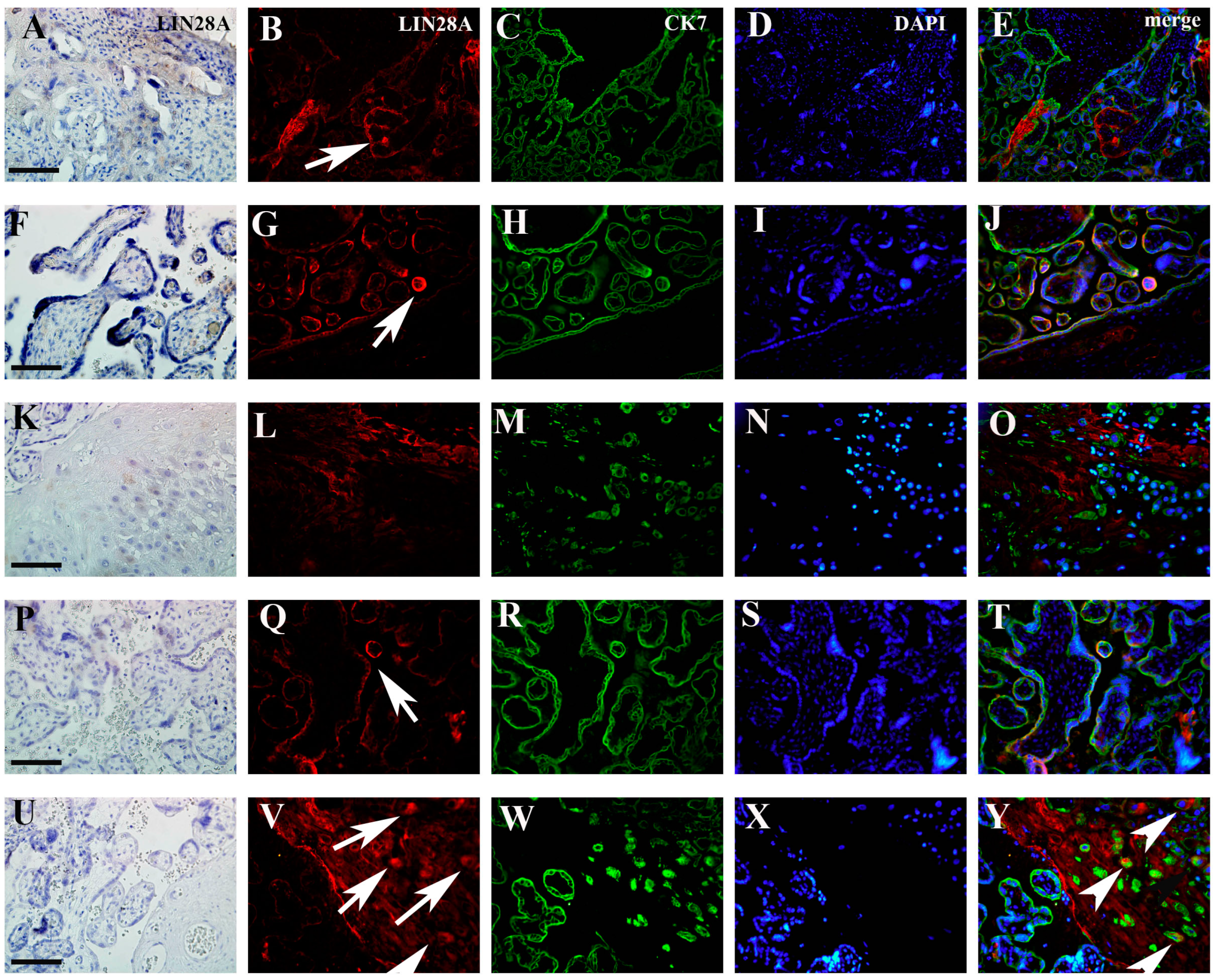 Biomedicines 12 00879 g005