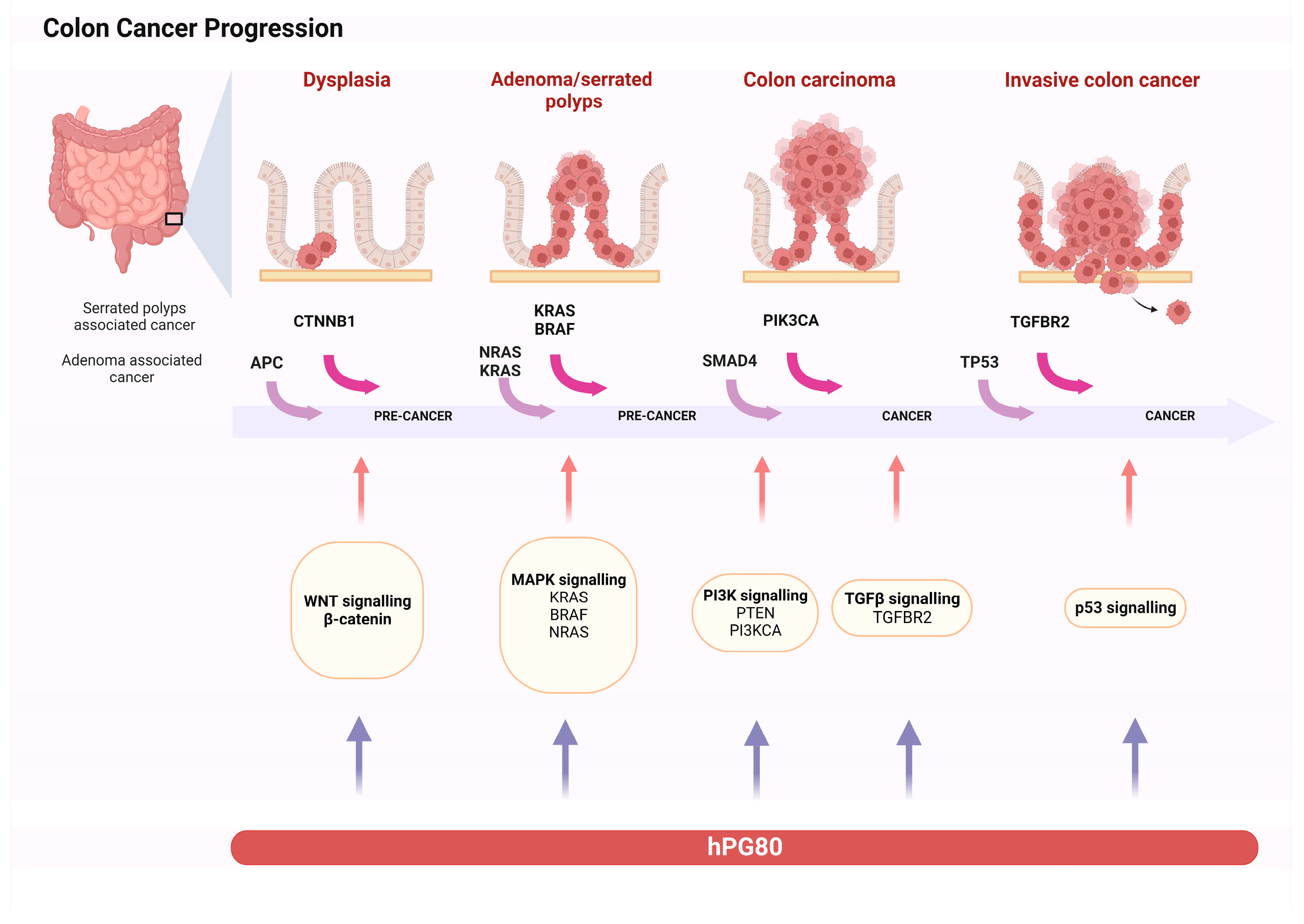 Biomedicines | Free Full-Text | Progastrin: An Overview of Its Crucial Role  in the Tumorigenesis of Gastrointestinal Cancers