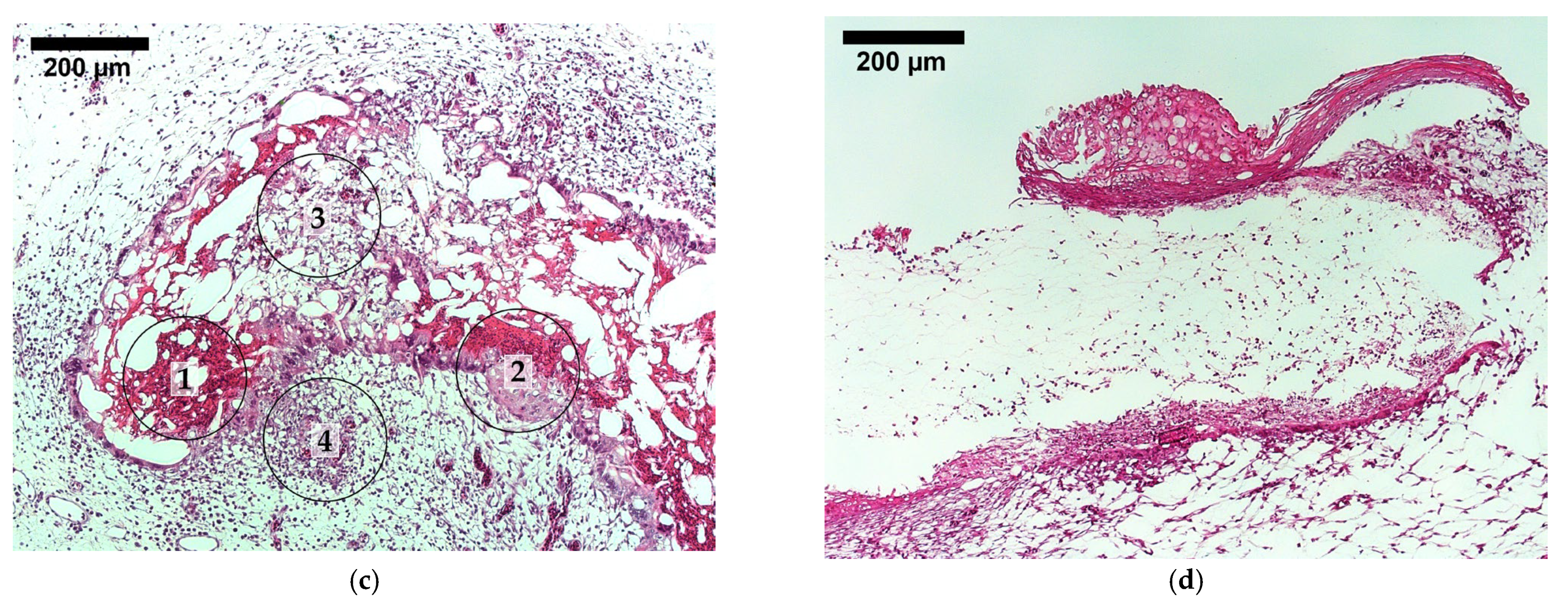 Biomedicines 12 01155 g008b