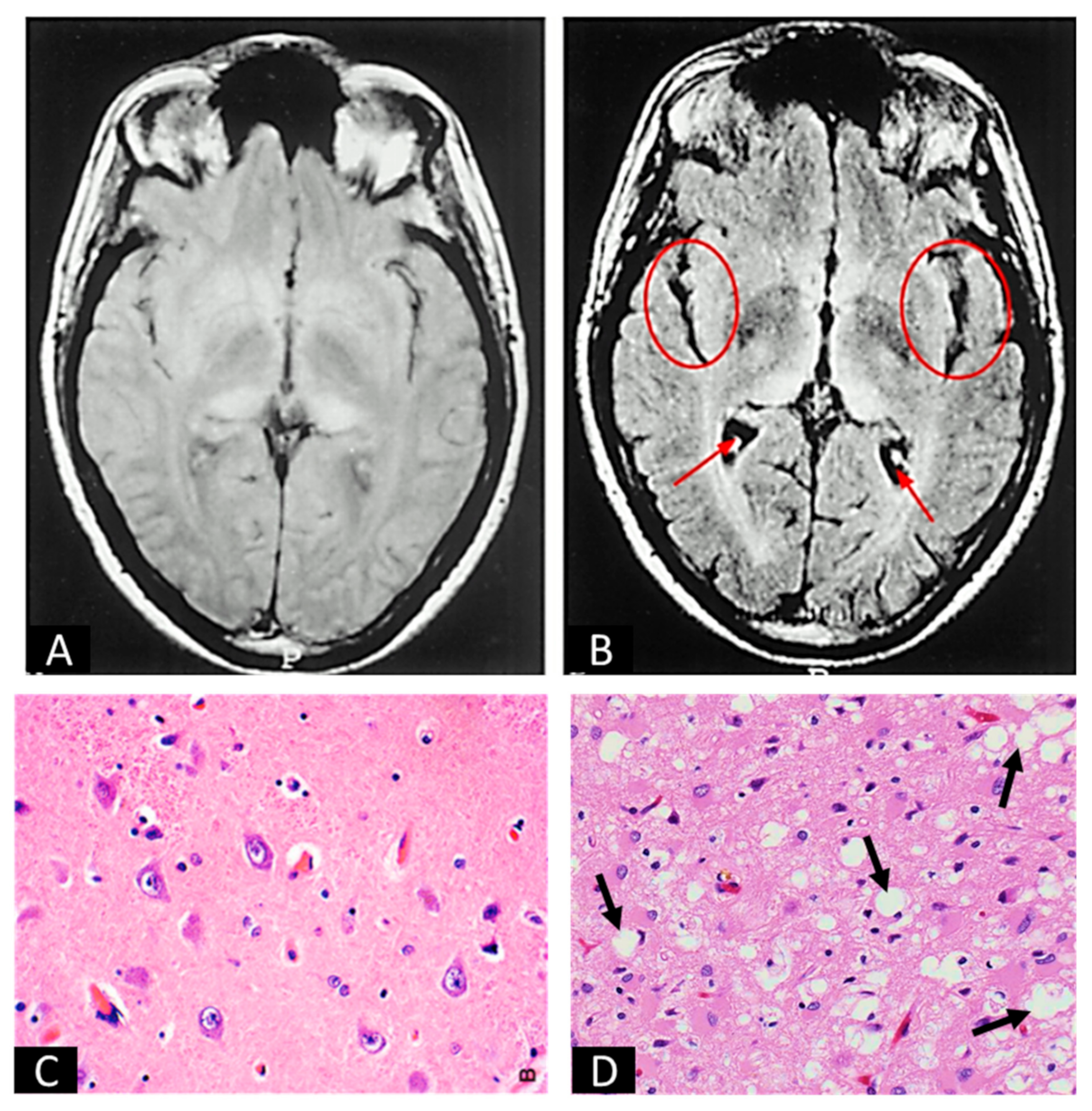 Biomedicines 12 01725 g002 Biomedicines 12 01725 g002
