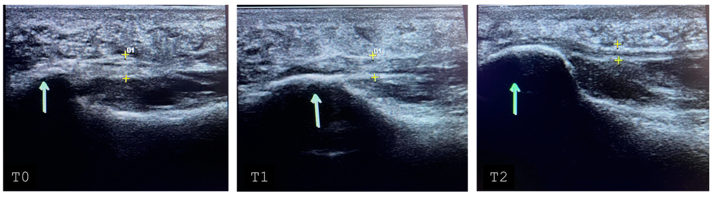 Biomedicines 12 01729 g003 Biomedicines 12 01729 g003