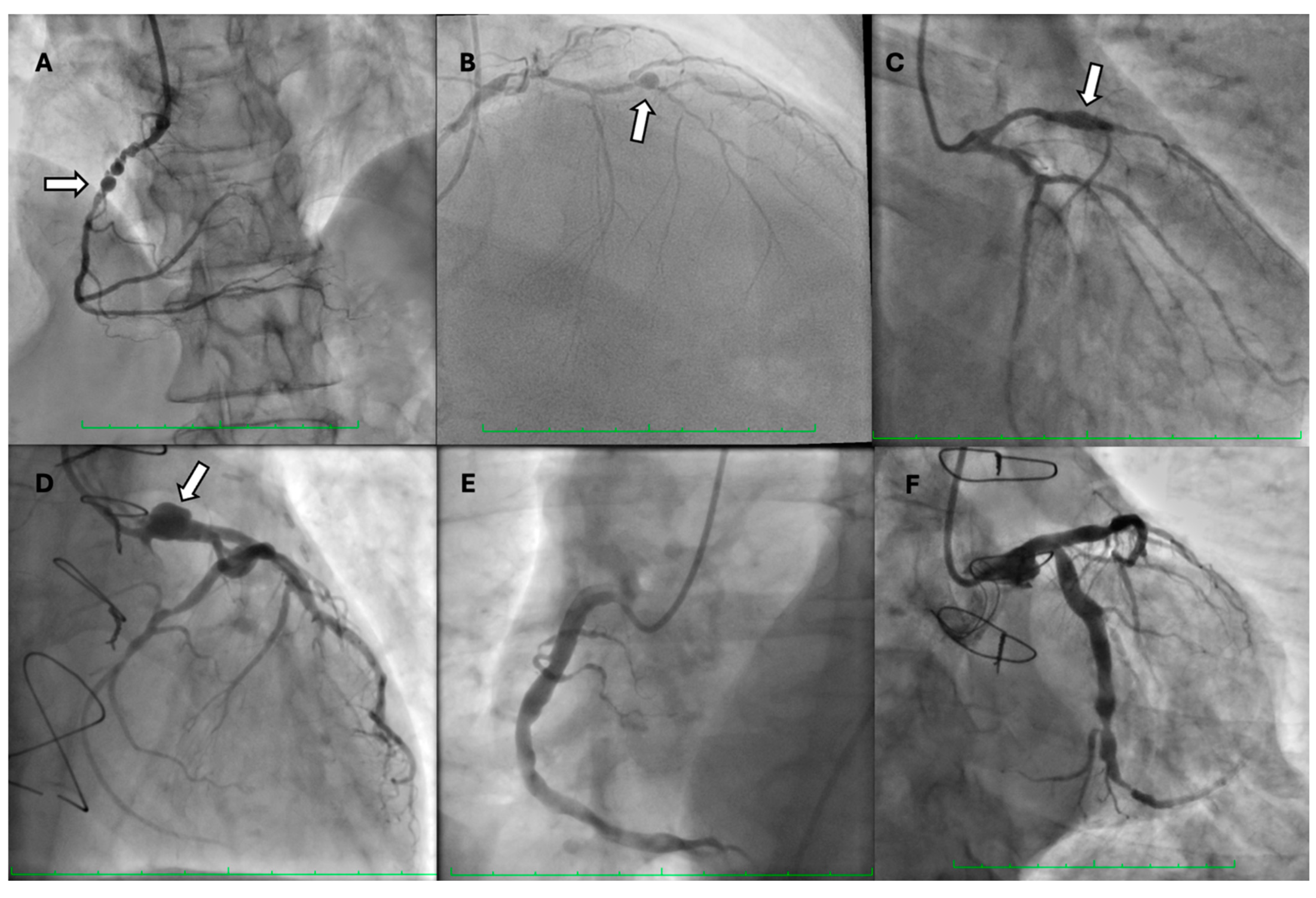 Biomedicines 12 01984 g002 Biomedicines 12 01984 g002
