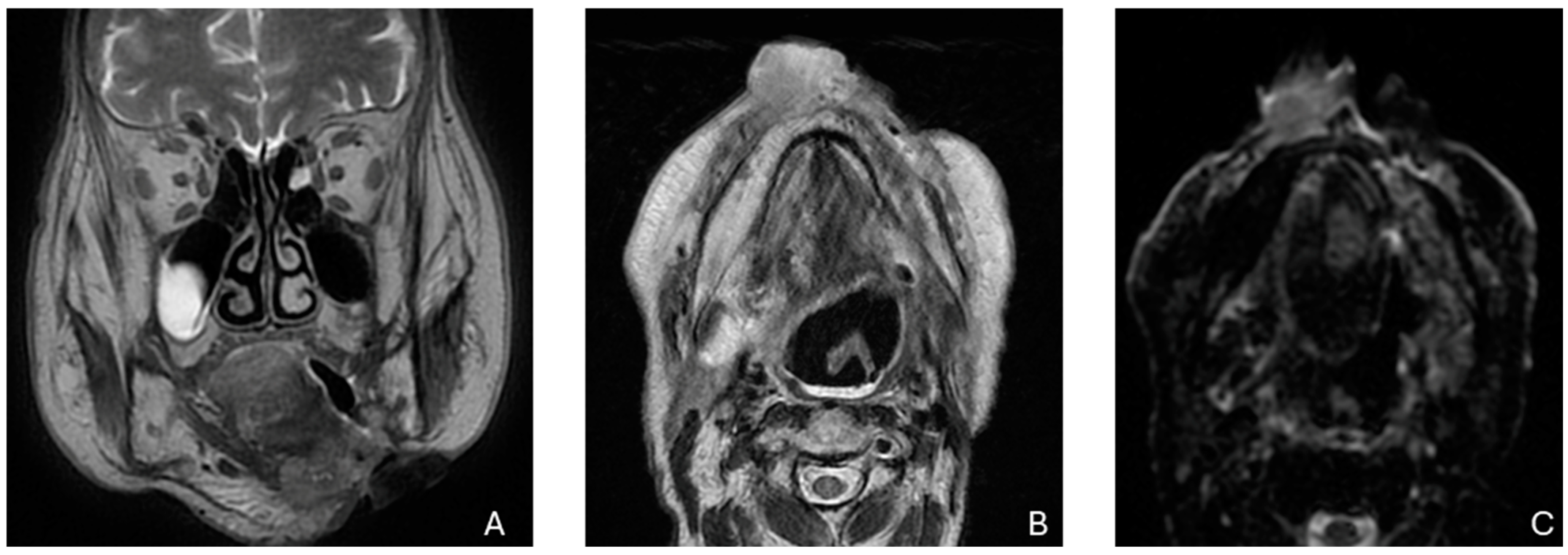 Biomedicines 12 02080 g001 Biomedicines 12 02080 g001